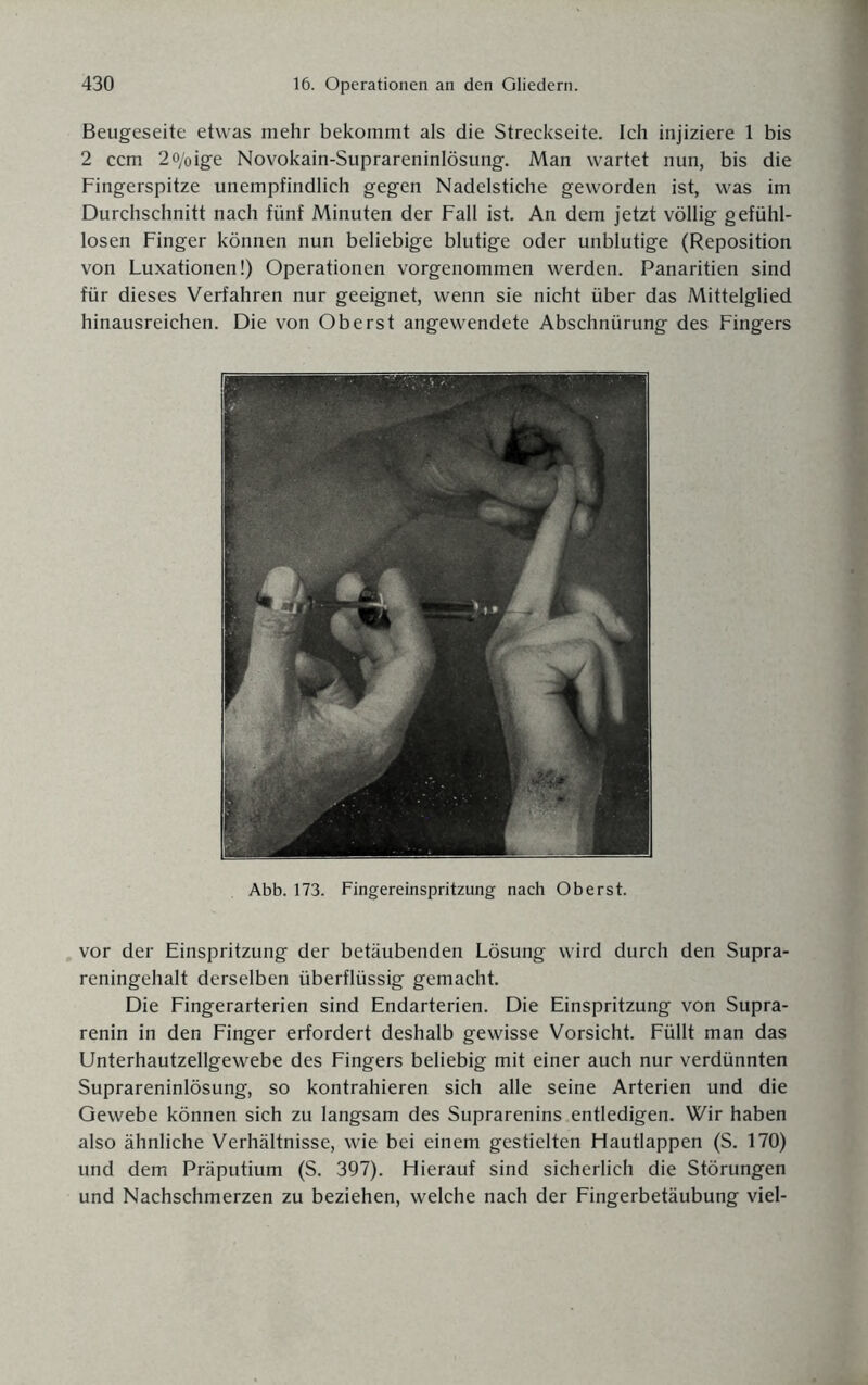 Beugeseite etwas mehr bekommt als die Streckseite. Ich injiziere 1 bis 2 ccm 2o/oige Novokain-Suprareninlösung. Man wartet nun, bis die Fingerspitze unempfindlich gegen Nadelstiche geworden ist, was im Durchschnitt nach fünf Minuten der Fall ist. An dem jetzt völlig gefühl¬ losen Finger können nun beliebige blutige oder unblutige (Reposition von Luxationen!) Operationen vorgenommen werden. Panaritien sind für dieses Verfahren nur geeignet, wenn sie nicht über das Mittelglied hinausreichen. Die von Oberst angewendete Abschnürung des Fingers Abb. 173. Fingereinspritzung nach Oberst. vor der Einspritzung der betäubenden Lösung wird durch den Supra- reningehalt derselben überflüssig gemacht. Die Fingerarterien sind Endarterien. Die Einspritzung von Supra- renin in den Finger erfordert deshalb gewisse Vorsicht. Füllt man das Unterhautzellgewebe des Fingers beliebig mit einer auch nur verdünnten Suprareninlösung, so kontrahieren sich alle seine Arterien und die Gewebe können sich zu langsam des Suprarenins entledigen. Wir haben also ähnliche Verhältnisse, wie bei einem gestielten Hautlappen (S. 170) und dem Präputium (S. 397). Hierauf sind sicherlich die Störungen und Nachschmerzen zu beziehen, welche nach der Fingerbetäubung viel-