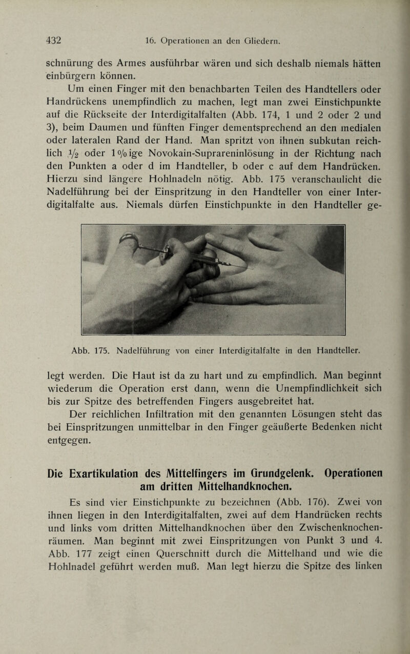 Schnürung des Armes ausführbar wären und sich deshalb niemals hätten einbürgern können. Um einen Finger mit den benachbarten Teilen des Handtellers oder Handrückens unempfindlich zu machen, legt man zwei Einstichpunkte auf die Rückseite der Interdigitalfalten (Abb. 174, 1 und 2 oder 2 und 3), beim Daumen und fünften Finger dementsprechend an den medialen oder lateralen Rand der Hand. Man spritzt von ihnen subkutan reich¬ lich ,1/2 oder lo/oige Novokain-Suprareninlösung in der Richtung nach den Punkten a oder d im Handteller, b oder c auf dem Handrücken. Hierzu sind längere Hohlnadeln nötig. Abb. 175 veranschaulicht die Nadelführung bei der Einspritzung in den Handteller von einer Inter¬ digitalfalte aus. Niemals dürfen Einstichpunkte in den Handteller ge- Abb. 175. Nadelführung von einer Interdigitalfalte in den Handteller. legt werden. Die Haut ist da zu hart und zu empfindlich. Man beginnt wiederum die Operation erst dann, wenn die Unempfindlichkeit sich bis zur Spitze des betreffenden Fingers ausgebreitet hat. Der reichlichen Infiltration mit den genannten Lösungen steht das bei Einspritzungen unmittelbar in den Finger geäußerte Bedenken nicht entgegen. Die Exartikulation des Mittelfingers im Grundgelenk. Operationen am dritten Mittelhandknochen. Es sind vier Einstichpunkte zu bezeichnen (Abb. 176). Zwei von ihnen liegen in den Interdigitalfalten, zwei auf dem Handrücken rechts und links vom dritten Mittelhandknochen über den Zwischenknochen¬ räumen. Man beginnt mit zwei Einspritzungen von Punkt 3 und 4. Abb. 177 zeigt einen Querschnitt durch die Mittelhand und wie die Hohlnadel geführt werden muß. Man legt hierzu die Spitze des linken
