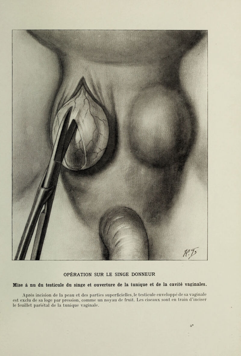 Mise à nu du testicule du singe et ouverture de la tunique et de la cavité vaginales. Après incision de la peau et des part ies superficielles, le testicule enveloppé de sa vaginale est exclu de sa loge par pression, comme un noyau de fruit. Les ciseaux sont en train d’inciser le feuillet pariétal de la tunique vaginale. a*