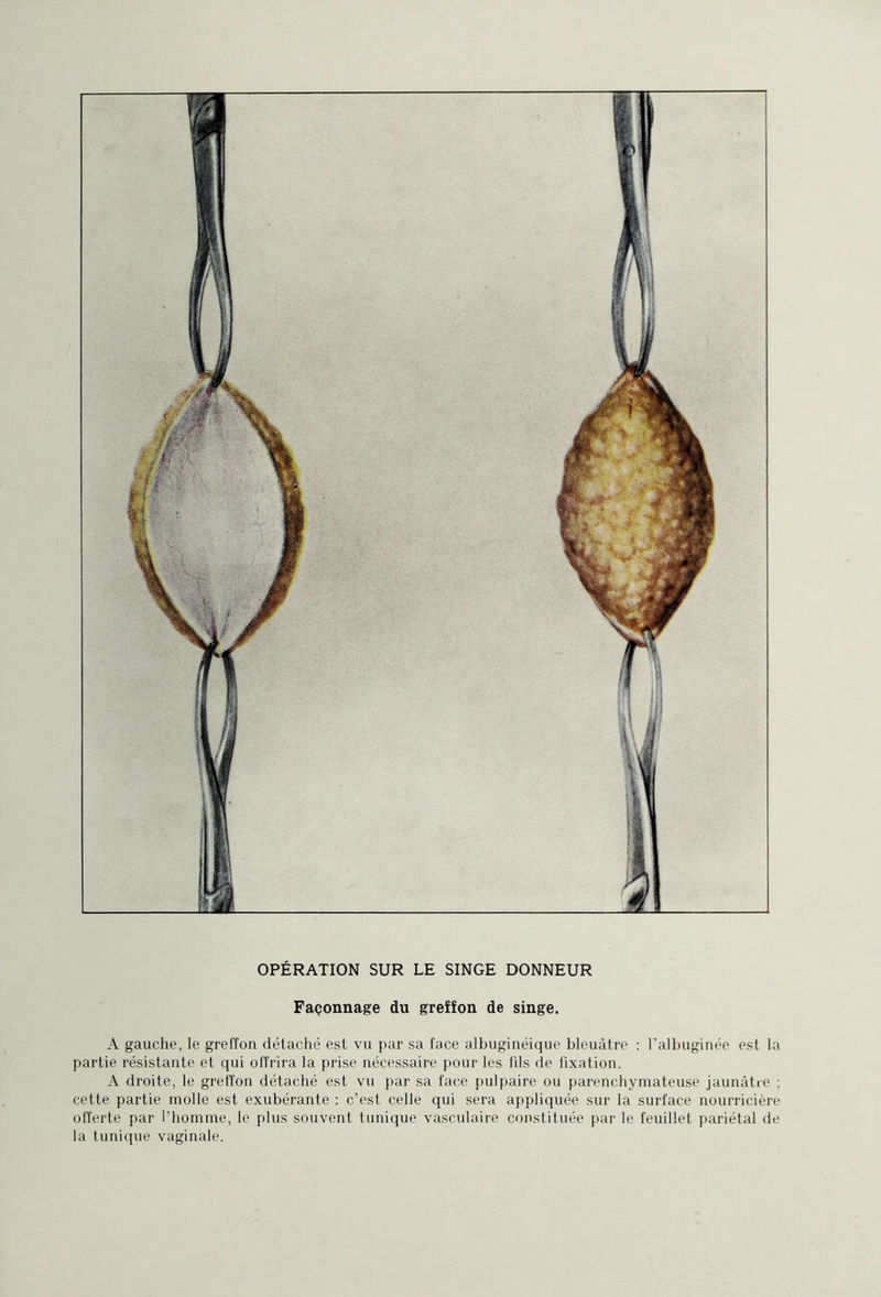 Façonnage du greîîon de singe. A gauche, le greffon détaché est vu par sa face albuginéique bleuâtre : l'albuginée est la partie résistante et qui offrira la prise nécessaire pour les fils de fixation. A droite, le greffon détaché est vu par sa face pulpaire ou parenchymateuse jaunâtre : cette partie molle est exubérante : c’est celle qui sera appliquée sur la surface nourricière offerte par l’homme, le plus souvent tunique vasculaire constituée par le feuillet pariétal de la tunique vaginale.