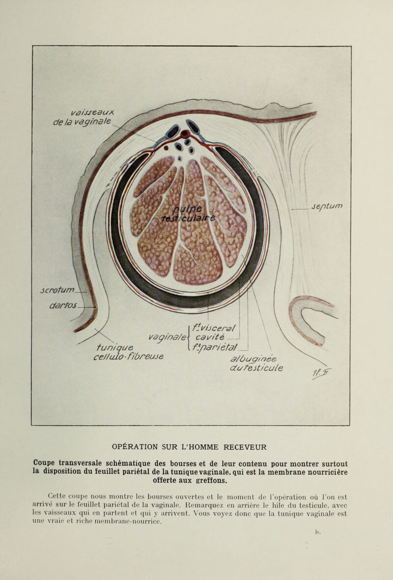 septum vaisseau* de là vagin à le scrotum dartos ce//ulo - fibreuse OPÉRATION SUR L’HOMME RECEVEUR Coupe transversale schématique des bourses et de leur contenu pour montrer surtout la disposition du feuillet pariétal de la tunique vaginale, qui est la membrane nourricière offerte aux greffons. Cette coupe nous montre les bourses ouvertes et le moment de l’opération où l’on est arrivé sur le feuillet pariétal de la vaginale. Remarquez en arrière le hile du testicule, avec les vaisseaux qui en partent et qui y arrivent. Vous voyez donc que la tunique vaginale est une vraie et riche membrane-nourrice. b.