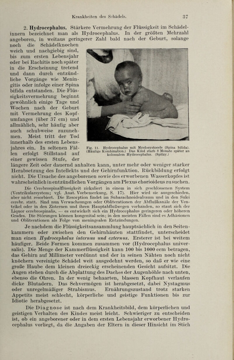 2. Hydroceplialus. Stärkere Vermehrung der Flüssigkeit im Scliädel- i unern bezeichnet man als Hydrocephalus. In der größten Mehrzahl angeboren, in weitaus geringerer Zahl bald nach der Geburt, solange noch die Schädelknochen weich und nachgiebig sind, bis zum ersten Lebensjahr oder bei Rachitis noch später in die Erscheinung tretend und dann durch entzünd¬ liche Vorgänge wie Menin¬ gitis oder infolge einer Spina bifida entstanden. Die-Flüs¬ sigkeitsvermehrung beginnt gewöhnlich einige Tage und Wochen nach der Geburt mit Vermehrung des Kopf- umfanges (über 37 cm) und allmählich, sehr häufig aber auch schubweise zuzuneh¬ men. Meist tritt der Tod innerhalb des ersten Lebens¬ jahres ein. In seltenen Fäl¬ len erfolgt Stillstand auf einer gewissen Stufe, der längere Zeit oder dauernd anhalten kann, unter mehr oder weniger starker Herabsetzung des Intellekts und der Gehirnfunktion. Rückbildung erfolgt nicht. Die Ursache des angeborenen sowie des erworbenen Wasserkopfes ist wahrscheinlich in entzündlichen Vorgängen am Plexus chorioideus zu suchen. Fig. 11. Hydrocephalus mit Myelocystocele (Spina bifida). (Häufige Kombination.) Das Kind starb 8 Monate später an kolossalem Hydrocephalus. (Spitzy.) Die Cerebrospinalflüssigkeit zirkuliert in einem in sich geschlossenen System (Ventrikularsystem; vgl. Anat. Vorbemerkung, S. 17). Hier wird sie ausgeschieden, aber nicht resorbiert. Die Resorption findet im Subarachnoidealraum und in den Sulci cerebr. statt. Sind nun Verwachsungen oder Obliterationen der Abflußkanäle der Ven¬ trikel oder in den Zisternen und ihren Hauptabflußwegen vorhanden, so staut sich der Liquor cerebrospinalis, — es entwickelt sich ein Hydrocephalus geringeren oder höheren Grades. Die Störungen können kongenital sein; in den meisten Fällen sind es Adhäsionen und Obliterationen als Folge von meningealen Entzündungen. Je nachdem die Flüssigkeitsansammlung hauptsächlich in den Seiten¬ kammern oder zwischen den Gehirnhäuten stattfindet, unterscheidet man einen Hydrocephalus internus und externus. Ersterer ist bei weitem häufiger. Beide Formen kommen zusammen vor (Hydrocephalus univer- salis). Die Menge der Kammerflüssigkeit kann 100 bis 1000 ccm betragen, das Gehirn auf Millimeter verdünnt und der in seinen Nähten noch nicht knöchern vereinigte Schädel weit ausgedehnt werden, so daß er wie eine große Haube dem kleinen dreieckig erscheinenden Gesicht aufsitzt. Die Augen stehen durch die Abplattung des Daches der Augenhöhle nach unten, ebenso die Ohren. In der wenig behaarten, blassen Kopfhaut verlaufen dicke Blutadern. Das Sehvermögen ist herabgesetzt, dabei Nystagmus oder unregelmäßiger Strabismus. Ernährungszustand trotz starken Appetits meist schlecht, körperliche und geistige Funktionen bis zur Idiotie herabgesetzt. Die Diagnose ist nach dem Krankheitsbild, dem körperlichen und geistigen Verhalten des Kindes meist leicht. Schwieriger zu entscheiden ist, ob ein angeborener oder in dem ersten Lebensjahr erworbener Hydro¬ cephalus vorliegt, da die Angaben der Eltern in dieser Hinsicht im Stich