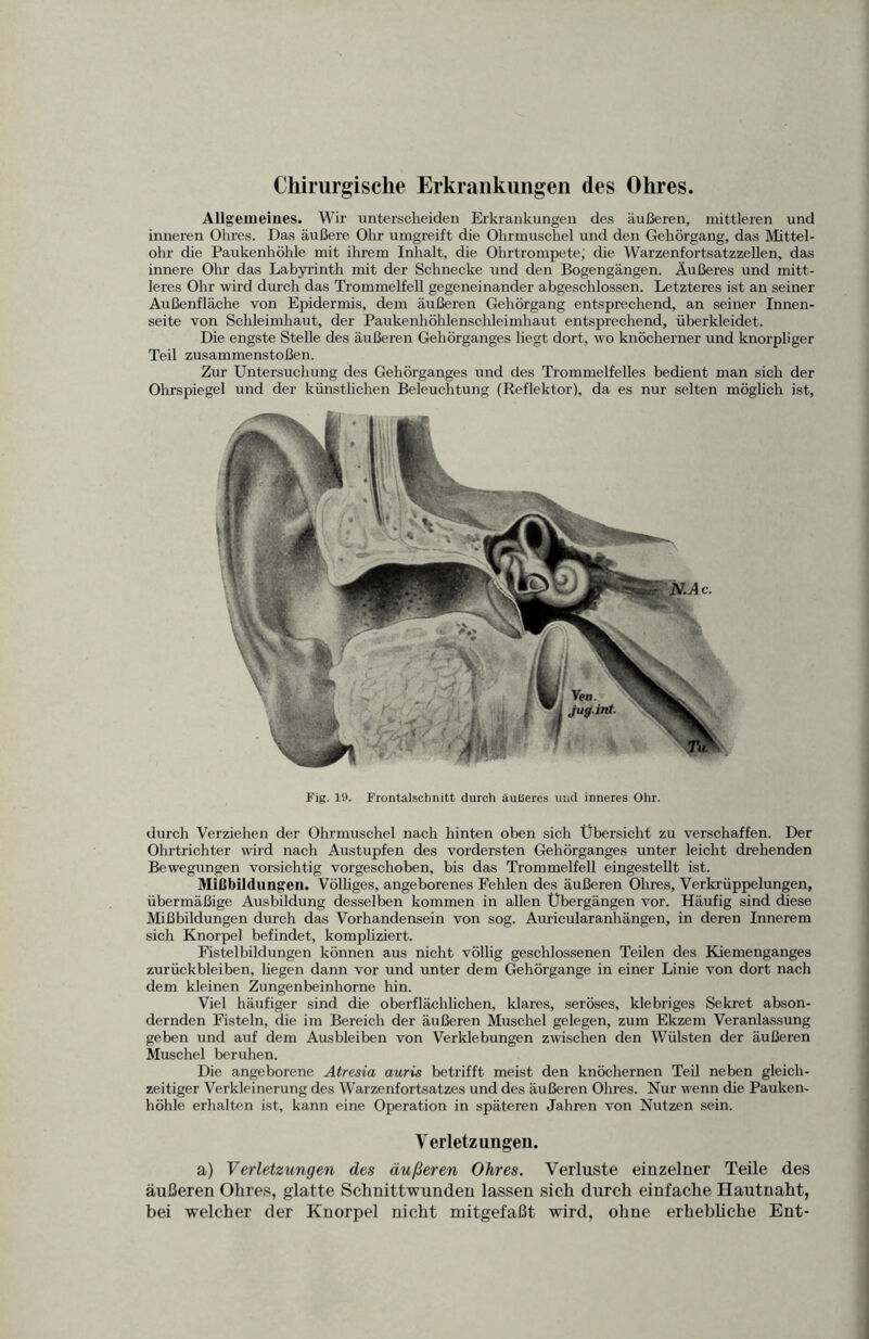 Allgemeines. Wir unterscheiden Erkrankungen des äußeren, mittleren und inneren Ohres. Das äußere Ohr umgreift die Ohrmuschel und den Gehörgang, das Mittel¬ ohr die Paukenhöhle mit ihrem Inhalt, die Ohrtrompete; die Warzenfortsatzzellen, das innere Ohr das Labyrinth mit der Schnecke und den Bogengängen. Äußeres und mitt¬ leres Ohr wird durch das Trommelfell gegeneinander abgeschlossen. Letzteres ist an seiner Außenfläche von Epidermis, dem äußeren Gehörgang entsprechend, an seiner Innen¬ seite von Schleimhaut, der Paukenhöhlenschleimhaut entsprechend, überkleidet. Die engste Stelle des äußeren Gehörganges liegt dort, wo knöcherner und knorpliger Teil Zusammenstößen. Zur Untersuchung des Gehörganges und des Trommelfelles bedient man sich der Ohrspiegel und der künstlichen Beleuchtung (Reflektor), da es nur selten möglich ist, Fig. 19. Frontalschnitt durch äußeres und inneres Ohr. durch Verziehen der Ohrmuschel nach hinten oben sich Übersicht zu verschaffen. Der Ohrtrichter wird nach Austupfen des vordersten Gehörganges unter leicht drehenden Bewegungen vorsichtig vorgeschoben, bis das Trommelfell eingestellt ist. Mißbildungen. Völliges, angeborenes Fehlen des äußeren Ohres, Verkrüppelungen, übermäßige Ausbildung desselben kommen in allen Übergängen vor. Häufig sind diese Mißbildungen durch das Vorhandensein von sog. Auricularanhängen, in deren Innerem sich Knorpel befindet, kompliziert. Fistelbildungen können aus nicht völlig geschlossenen Teilen des Kiemenganges Zurückbleiben, liegen dann vor und unter dem Gehörgange in einer Linie von dort nach dem kleinen Zungenbeinhorne hin. Viel häufiger sind die oberflächlichen, klares, seröses, klebriges Sekret abson¬ dernden Fisteln, die im Bereich der äußeren Muschel gelegen, zum Ekzem Veranlassung geben und auf dem Ausbleiben von Verklebungen zwischen den Wülsten der äußeren Muschel beruhen. Die angeborene Atresia auris betrifft meist den knöchernen Teil neben gleich¬ zeitiger Verkleinerung des Warzenfortsatzes und des äußeren Ohres. Nur wenn die Pauken¬ höhle erhalten ist, kann eine Operation in späteren Jahren von Nutzen sein. Verletzungen. a) Verletzungen des äußeren Ohres. Verluste einzelner Teile des äußeren Ohres, glatte Schnittwunden lassen sich durch einfache Hautnaht, bei welcher der Knorpel nicht mitgefaßt wird, ohne erhebliche Ent-