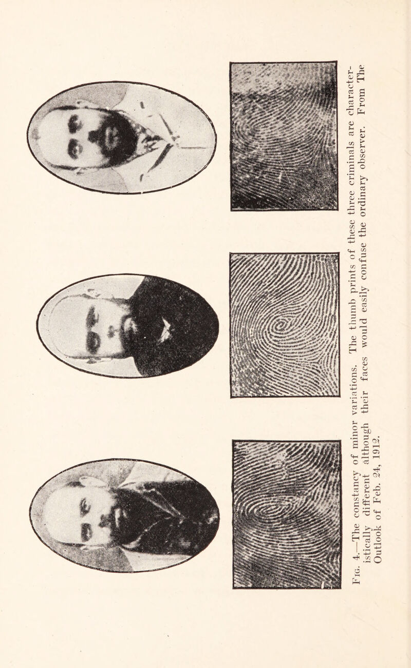 4. The constancy of minor variations. The thumb prints of these three criminals are character istically different although their faces would easily confuse the ordinary observer. From The Outlook of Feb. 24, 1912.