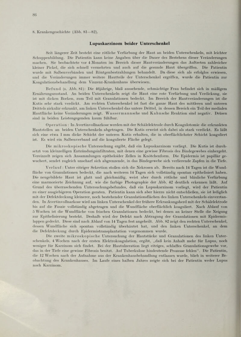 8. Krankengeschichte (Abb. 81—82). Lupuskarzinom beider Unterschenkel Seit längerer Zeit besteht eine rötliche Verfärbung der Haut an beiden Unterschenkeln, mit leichter Schuppenbildung. Die Patientin kann keine Angaben über die Dauer des Bestehens dieser Veränderungen machen. Sie beobachtete vor 4 Monaten im Bereich dieser Hautveränderungen das Auftreten zahlreicher kleiner Pickel, die sich schnell vermehrten und auch auf die gesunde Haut Übergriffen. Die Patientin wurde mit Salbenverbänden und Röntgenbestrahlungen behandelt. Da diese sich als erfolglos erwiesen, und die Veränderungen immer weitere Hautteile der Unterschenkel ergriffen, wurde die Patientin zur Koagulationsbehandlung dem Vinzenz-Krankenhaus überwiesen. Befund (s. Abb. 81): Die 46jährige, blaß aussehende, schmächtige Frau befindet sich in mäßigem Ernährungszustand. An beiden Unterschenkeln zeigt die Haut eine rote Verfärbung und Verdickung, sie ist mit dicken Borken, zum Teil mit Granulationen bedeckt. Im Bereich der Hautveränderungen ist die Kutis sehr stark verdickt. Am rechten Unterschenkel ist fast die ganze Haut des mittleren und unteren Drittels zirkulär erkrankt, am linken Unterschenkel das untere Drittel, in dessen Bereich ein Teil der medialen Hautfläche keine Veränderungen zeigt. Wassermannsche und Kahnsche Reaktion sind negativ. Drüsen sind in beiden Leistengegenden kaum fühlbar. Operat ion : In Avertinvollnarkose werden mit der Schälelektrode durch Koagulotomie die erkrankten Hautstellen an beiden Unterschenkeln abgetragen. Die Kutis erweist sich dabei als stark verdickt. Es läßt sich eine etwa 1 mm dicke Schicht der unteren Kutis erhalten, die in oberflächlichster Schicht koaguliert ist. Es wird ein Salbenverband auf die koagulierte Fläche gelegt. Die mikroskopische Untersuchung ergibt, daß ein Lupuskarzinom vorliegt. Die Kutis ist durch¬ setzt von kleinzelligen Entzündungsinfiltraten, mit denen eine gewisse Fibrosis des Bindegewebes einhergeht. Vereinzelt zeigen sich Ansammlungen epitheloider Zellen in Knötchenform. Die Epidermis ist papillär ge¬ wuchert, sendet zugleich unscharf sich abgrenzende, in das Bindegewebe sich verlierende Zapfen in die Tiefe. Verlauf : Unter eitriger Sekretion stoßen sich die Nekrosen ab. Bereits nach 14 Tagen ist die Wund¬ fläche von Granulationen bedeckt, die nach weiteren 14 Tagen sich vollständig spontan epithelisiert haben. Die neugebildete Haut ist glatt und gleichmäßig, weist aber durch rötliche und bläuliche Verfärbung eine marmorierte Zeichnung auf, wie die farbige Photographie der Abb. 42 deutlich erkennen läßt. Auf Grund des überraschenden Untersuchungsbefundes, daß ein Lupuskarzinom vorliegt, wird der Patientin zu einer ausgiebigeren Operation geraten. Patientin kann sich aber hierzu nicht entschließen, sie ist lediglich mit der Defektdeckung kleinerer, noch bestehender Granulationsflächen des linken Unterschenkels einverstan¬ den. In Avertinvollnarkose wird am linken Unterschenkel der frühere Erkrankungsherd mit der Schälelektrode bis auf die Faszie vollständig abgetragen und die Wundfläche oberflächlich koaguliert. Nach Ablauf von 5 W ochen ist die Wundfläche von frischen Granulationen bedeckt, bei denen an keiner Stelle die Neigung zur Epithelisierung besteht. Deshalb wird der Defekt nach Abtragung der Granulationen mit Epidermis- lappen gedeckt. Diese sind nach Ablauf von 14 Tagen fest angeheilt . Abb. 82 zeigt den rechten Unterschenkel, dessen Whmdfläche sich spontan vollständig überhäutet hat, und den linken Unterschenkel, an dem die Defektdeckung durch Epidermistransplantation vorgenommen wurde. Die zweite mikroskopische Untersuchung der Hautstücke und Granulationen des linken Unter¬ schenkels, 4 Wochen nach der ersten Elektrokoagulation, ergibt, ,,daß kein Anhalt mehr für Lupus, noch weniger für Karzinom sich findet. Bei der Haiitulzeration liegt eitriges, schlaffes Granulationsgewebe vor, das in der Tiefe eine gewisse Fibrosis besitzt. Auf Tuberkulose hindeutende Prozesse fehlen“. Die Patientin, die 12 Wochen nach der Aufnahme aus der Krankenhausbehandlung entlassen wurde, blieb in weiterer Be¬ obachtung des Krankenhauses. Im Laufe eines halben Jahres zeigte sich bei der Patientin weder Lupus noch Karzinom.