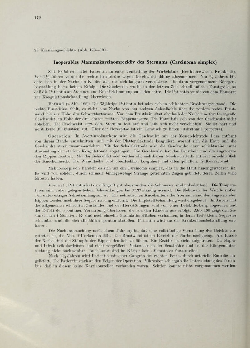 39. Krankengeschichte (Abb. 188—191). Inoperables Mammakarzinomrezidiv des Sternums (Carcinoma simplex) Seit 10 Jahren leidet Patientin an einer Versteifung der Wirbelsäule (Bechterewsche Krankheit). Vor 1 y2 Jahren wurde die rechte Brustdrüse wegen Geschwulstbildung abgenommen. Vor % Jahren bil¬ dete sich in der Narbe ein Knoten aus, der sich langsam vergrößerte. Die dann vorgenommene Röntgen¬ bestrahlung hatte keinen Erfolg. Die Geschwulst wuchs in der letzten Zeit schnell auf fast Faustgroße, so daß die Patientin an Atemnot und Brustbeklemmung zu leiden hatte. Die Patientin wurde von dem Hausarzt zur Koagulationsbehandlung überwiesen. Befund (s. Abb. 188): Die 73jährige Patientin befindet sich in schlechtem Ernährungszustand. Die rechte Brustdrüse fehlt, es zieht eine Narbe von der rechten Achselhöhle über die vordere rechte Brust¬ wand bis zur Höhe des Schwertfortsatzes. Vor dem Brustbein sitzt oberhalb der Narbe eine fast faustgroße Geschwulst, in Höhe der drei oberen rechten Rippenansätze. Die Haut läßt sich von der Geschwulst nicht abheben. Die Geschwulst sitzt dem Sternum fest auf und läßt sich nicht verschieben. Sie ist hart und weist keine Fluktuation auf. Über der Herzspitze ist ein Geräusch zu hören (Arhythmia perpetua). Operation : In Avertinvollnarkose wird die Geschwulst mit der Messerelektrode 1 cm entfernt von ihrem Rande Umschnitten, und mit der Plattenelektrode koaguliert, worauf sich die Haut und die Geschwulst stark zusammenziehen. Mit der Schälelektrode wird die Geschwulst dann schichtweise unter Anwendung der starken Koagulotomie abgetragen. Die Geschwulst hat das Brustbein und die angrenzen¬ den Rippen zerstört. Mit der Schälelektrode werden alle sichtbaren Geschwulstteile entfernt einschließlich der Knochenherde. Die Wundfläche wird oberflächlich koaguliert und offen gehalten. Salben verband. Mikroskopisch handelt es sich um ein Carcinoma simplex, das in die Haut hineingewachsen ist. Es wird von soliden, durch schmale bindegewebige Stränge getrennten Zügen gebildet, deren Zellen viele Mitosen haben. Verlauf : Patientin hat den Eingriff gut überstanden, die Schmerzen sind unbedeutend. Die Tempera¬ turen sind außer gelegentlichen Schwankungen bis 37,3° ständig normal. Die Nekrosen der Wunde stoßen sich unter eitriger Sekretion langsam ab. Die nekrotischen Knochenteile des Sternums und der angrenzenden Rippen werden nach ihrer Sequestrierung entfernt. Die Impfstoffbehandlung wird eingeleitet. In Anbetracht des allgemeinen schlechten Zustandes und der Herzstörungen wird von einer Defektdeckung abgesehen und der Defekt der spontanen Vernarbung überlassen, die von den Rändern aus erfolgt. Abb. 190 zeigt den Zu¬ stand nach 4 Monaten. Es sind noch einzelne Granulationsflächen vorhanden, in deren Tiefe kleine Sequester erkennbar sind, die sich allmählich spontan abstoßen. Patientin wird aus der Krankenhausbehandlung ent¬ lassen. Die Nachuntersuchung nach einem Jahr ergibt, daß eine vollständige Vernarbung des Defekts ein¬ getreten ist, die Abb. 191 erkennen läßt. Die Brustwand ist im Bereich der Narbe nachgiebig. Am Rande der Narbe sind die Stümpfe der Rippen deutlich zu fühlen. Ein Rezidiv ist nicht aufgetreten. Die Supra- und Infraklavikulardrüsen sind nicht vergrößert. Metastasen in der Brusthöhle sind bei der Röntgenunter¬ suchung nicht nachweisbar. Auch sonst sind im Körper keine Metastasen festzustellen. Nach 1 % Jahren wird Patientin mit einer Gangrän des rechten Beines durch arterielle Embolie ein¬ geliefert. Die Patientin starb an den Folgen der Operation. Mikroskopisch ergab die Untersuchung des Throm¬ bus, daß in diesem keine Karzinomzellen vorhanden waren. Sektion konnte nicht vorgenommen werden.