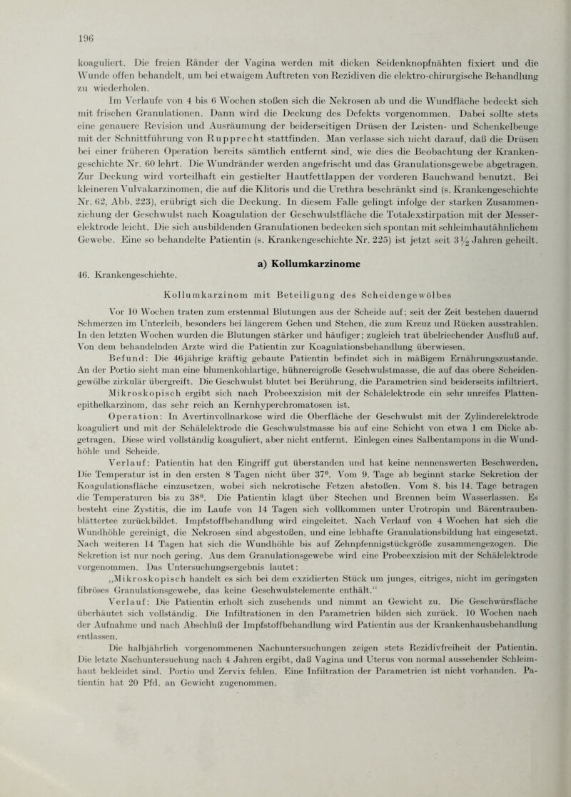 koaguliert. Die freien Ränder der Vagina werden mit dicken Seidenknopfnähten fixiert und die Wunde offen behandelt, um bei etwaigem Auftreten von Rezidiven che elektro-chirurgische Behandlung zu wiederholen. Im Verlaufe von 4 bis 6 Wochen stoßen sich die Nekrosen ab und die Wundfläche bedeckt sich mit frischen Granulationen. Dann wird die Deckung des Defekts vorgenommen. Dabei sollte stets eine genauere Revision und Ausräumung der beiderseitigen Drüsen der Leisten- und Schenkelbeuge mit der Schnittführung von Rupprecht stattfinden. Man verlasse sich nicht darauf, daß die Drüsen bei einer früheren Operation bereits sämtlich entfernt sind, wie dies die Beobachtung der Kranken¬ geschichte Nr. 60 lehrt. Die Wundränder werden angefrischt und das Granulationsgewebe abgetragen. Zur Deckung wird vorteilhaft ein gestielter Hautfettlappen der vorderen Bauchwand benutzt. Bei kleineren Vulvakarzinomen, die auf die Klitoris und die Urethra beschränkt sind (s. Krankengeschichte Nr. 62, Abb. 223), erübrigt sich die Deckung. In diesem Falle gelingt infolge der starken Zusammen¬ ziehung der Geschwulst nach Koagulation der Geschwulstfläche die Totalexstirpation mit der Messer¬ elektrode leicht. Die sich ausbildenden Granulationen bedecken sich spontan mit schleimhautähnlichem Gewebe. Eine so behandelte Patientin (s. Krankengeschichte Nr. 225) ist jetzt seit 3% Jahren geheilt. a) Kollumkarzinome 46. Krankengeschichte. Kollumkarzinom mit Beteiligung des Scheidengewölbes Vor 10 Wochen traten zum erstenmal Blutungen aus der Scheide auf; seit der Zeit bestehen dauernd Schmerzen im Unterleib, besonders bei längerem Gehen und Stehen, die zum Kreuz und Rücken ausstrahlen. In den letzten Wochen wurden die Blutungen stärker und häufiger; zugleich trat übelriechender Ausfluß auf. Von dem behandelnden Arzte wird die Patientin zur Koagulationsbehandlung überwiesen. Befund: Die 46jährige kräftig gebaute Patientin befindet sich in mäßigem Ernährungszustände. An der Portio sieht man eine blumenkohlartige, hühnereigroße Geschwulstmasse, die auf das obere Scheiden¬ gewölbe zirkulär übergreift. Die Geschwulst blutet bei Berührung, die Parametrien sind beiderseits infiltriert. Mikroskopisch ergibt sich nach Probeexzision mit der Schälelektrode ein sehr unreifes Platten¬ epithelkarzinom, das sehr reich an Kernhyperchromatosen ist. Operation: In Avertinvollnarkose wird die Oberfläche der Geschwulst mit der Zylinderelektrode koaguliert und mit der Schälelektrode die Geschwulstmasse bis auf eine Schicht von etwa 1 cm Dicke ab¬ getragen. Diese wird vollständig koaguliert, aber nicht entfernt. Einlegen eines Salbentampons in die Wund¬ höhle und Scheide. Verlauf: Patientin hat den Eingriff gut überstanden und hat keine nennenswerten Beschwerden. Die Temperatur ist in den ersten 8 Tagen nicht über 37°. Vom 9. Tage ab beginnt starke Sekretion der Koagulationsfläche einzusetzen, wobei sich nekrotische Fetzen abstoßen. Vom 8. bis 14. Tage betragen die Temperaturen bis zu 38°. Die Patientin klagt über Stechen und Brennen beim Wasserlassen. Es besteht eine Zystitis, die im Laufe von 14 Tagen sich vollkommen unter Urotropin und Bärentrauben¬ blättertee zurückbildet. Impfstoffbehandlung wird eingeleitet. Nach Verlauf von 4 Wochen hat sich die Wundhöhle gereinigt, die Nekrosen sind abgestoßen, und eine lebhafte Granulationsbildung hat eingesetzt. Nach weiteren 14 Tagen hat sich die Wundhöhle bis auf Zehnpfennigstückgröße zusammengezogen. Die Sekretion ist nur noch gering. Aus dem Granulationsgewebe wird eine Probeexzision mit der Schälelektrode vorgenommen. Das Untersuchungsergebnis lautet: „Mikroskopisch handelt es sich bei dem exzidierten Stück um junges, eitriges, nicht im geringsten fibröses Granulationsgewebe, das keine Geschwulstelemente enthält.“ Verlauf: Die Patientin erholt sich zusehends und nimmt an Gewicht zu. Die Geschwürsfläche überhäutet sich vollständig. Die Infiltrationen in den Parametrien bilden sich zurück. 10 Wochen nach der Aufnahme und nach Abschluß der Impfstoffbehandlung wird Patientin aus der Krankenhausbehandlung entlassen. Die halbjährlich vorgenommenen Nachuntersuchungen zeigen stets Rezidivfreiheit der Patientin. Die letzte Nachuntersuchung nach 4 Jahren ergibt, daß Vagina und Uterus von normal aussehender Schleim¬ haut bekleidet sind. Portio und Zervix fehlen. Eine Infiltration der Parametrien ist nicht vorhanden. Pa¬ tientin hat 20 Pfd. an Gewicht zugenommen.
