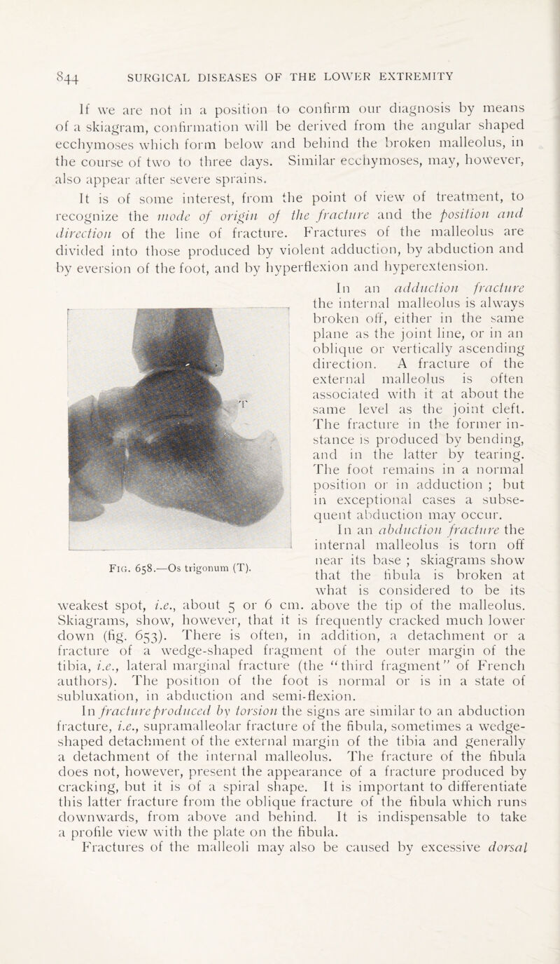 If we are not in a position to confirm our diagnosis by means of a skiagram, confirmation will be derived from the angular shaped ecchymoses which form below and behind the broken malleolus, in the course of two to three days. Similar ecchymoses, may, however, also appear after severe sprains. It is of some interest, from the point of view of treatment, to recognize the mode of origin of the fracture and the position and direction of the line of fracture. Fractures of the malleolus are divided into those produced by violent adduction, by abduction and by eversion of the foot, and by hyperflexion and hyperextension. In an adduction fracture the internal malleolus is always broken off, either in the same plane as the joint line, or in an oblique or vertically ascending direction. A fracture of the external malleolus is often associated with it at about the same level as the joint cleft. The fracture in the former in¬ stance is produced by bending, and in the latter by tearing. The foot remains in a normal position or in adduction ; but in exceptional cases a subse¬ quent abduction may occur. In an abduction fracture the internal malleolus is torn off near its base ; skiagrams show that the fibula is broken at what is considered to be its weakest spot, i.e., about 5 or 6 cm. above the tip of the malleolus. Skiagrams, show, however, that it is frequently cracked much lower down (fig. 653). There is often, in addition, a detachment or a fracture of a wedge-shaped fragment of the outer margin of the tibia, i.e., lateral marginal fracture (the “third fragment of French authors). The position of the foot is normal or is in a state of subluxation, in abduction and semi-flexion. In fracture produced by torsion the signs are similar to an abduction fracture, i.e., supramalleolar fracture of the fibula, sometimes a wedge- shaped detachment of the external margin of the tibia and generally a detachment of the internal malleolus. The fracture of the fibula does not, however, present the appearance of a fracture produced by cracking, but it is of a spiral shape. It is important to differentiate this latter fracture from the oblique fracture of the fibula which runs downwards, from above and behind. It is indispensable to take a profile view with the plate on the fibula. Fractures of the malleoli may also be caused by excessive dorsal