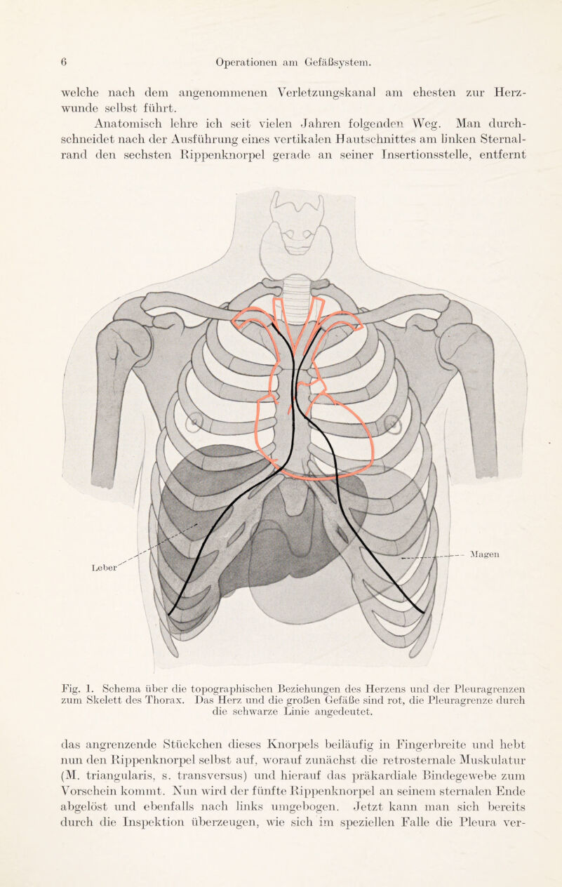 welche nach dem angenommenen Verletzungskana] am ehesten zur Herz- wunde selbst führt. Anatomisch lehre ich seit vielen Jahren folgenden Weg. Man durch- schneiclet nach der Ausführung eines vertikalen Hautschnittes am linken Sternal- rand den sechsten Rippenknorpel gerade an seiner Insertionsstelle, entfernt Fig. 1. Schema über die topographischen Beziehungen des Herzens und der Pleuragrenzen zum Skelett des Thorax. Das Herz und die großen Gefäße sind rot, die Pleuragrenze durch die schwarze Linie angedeutet. das angrenzende Stückchen dieses Knorpels beiläufig in Fingerbreite und hebt nun den Rippenknorpel selbst auf, worauf zunächst die retrosternale Muskulatur (M. triangularis, s. transversus) und hierauf das präkardiale Bindegewebe zum Vorschein kommt. Nun wird der fünfte Rippenknorpel an seinem sternalen Ende abgelöst und ebenfalls nach links umgebogen. Jetzt kann man sich bereits durch die Inspektion überzeugen, wie sich im speziellen Falle die Pleura ver-