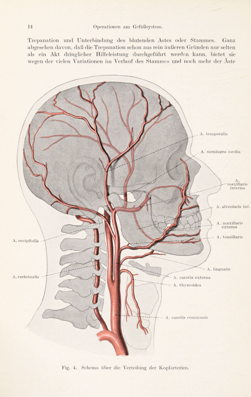 Trepanation nnd Unterbindung des blutenden Astes oder Stammes. Ganz abgesehen davon, daß die Trepanation schon aus rein äußeren Gründen nur selten als ein Akt dringlicher Hilfeleistung durchgeführt werden kann, bietet sie wegen der vielen Variationen im Verlauf des Stammes und noch mehr der Äste A. occipitalis A. m axillaris interna A. alveolaris inf. A. m axillaris externa A. tonsillaris  A. lingual is i. carotis externa - A. thyreoidea A. temporalis A. meningea media carotis communis Fig. 4. Schema über die Verteilung der Kopfarterien.