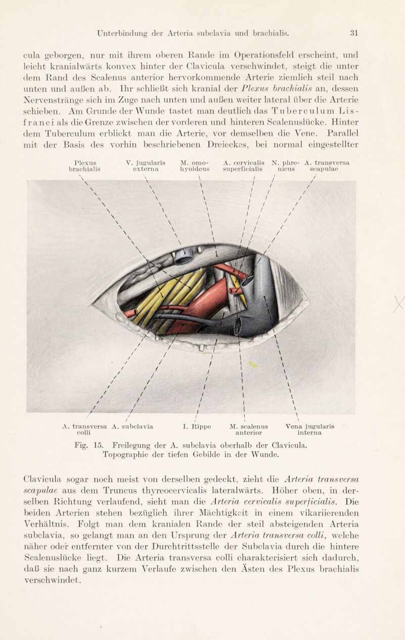 cula geborgen, nur mit ihrem oberen Rande im Operationsfeld erscheint, und leicht kranialwärts konvex hinter der Clavicula verschwindet, steigt die unter dem Rand des Scalenus anterior hervorkommende Arterie ziemlich steil nach unten und außen ab. Ihr schließt sich kranial der Plexus brachialis an, dessen Nervenstränge sich im Zuge nach unten und außen weiter lateral über die Arterie schieben. Am Grunde der Wunde tastet man deutlich das Tuberculum Lis- f ran ei als die Grenze zwischen der vorderen und hinteren Scalenuslücke. Hinter dem Tuberculum erblickt man die Arterie, vor demselben die Vene. Parallel mit der Basis des vorhin beschriebenen Dreieckes, bei normal eingestellter Plexus V. jugularis M. omo- A. cervicalis N. phre- A. transversa brachialis externa hyoideus superficialis nicus scapulae A. transversa A. subclavia I. Rippe M. sealenus Vena jugularis colli anterior interna Fig. 15. Freilegung der A. subclavia oberhalb der Clavicula. Topographie der tiefen Gebilde in der Wunde. Clavicula sogar noch meist von derselben gedeckt, zieht die Arteria transversa scapulae aus dem Truncus thyreocervicalis lateralwärts. Höher oben, in der¬ selben Richtung verlaufend, sieht man die Arteria cervicalis superficialis. Die beiden Arterien stehen bezüglich ihrer Mächtigkeit in einem vikariierenden Verhältnis. Folgt man dem kranialen Rande der steil absteigenden Arteria subclavia, so gelangt man an den Ursprung der Arteria transversa colli, welche näher oder entfernter von der Durchtrittsstelle der Subclavia durch die hintere Scalenuslücke liegt. Die Arteria transversa colli charakterisiert sich dadurch, daß sie nach ganz kurzem Verlaufe zwischen den Asten des Plexus brachialis verschwindet.