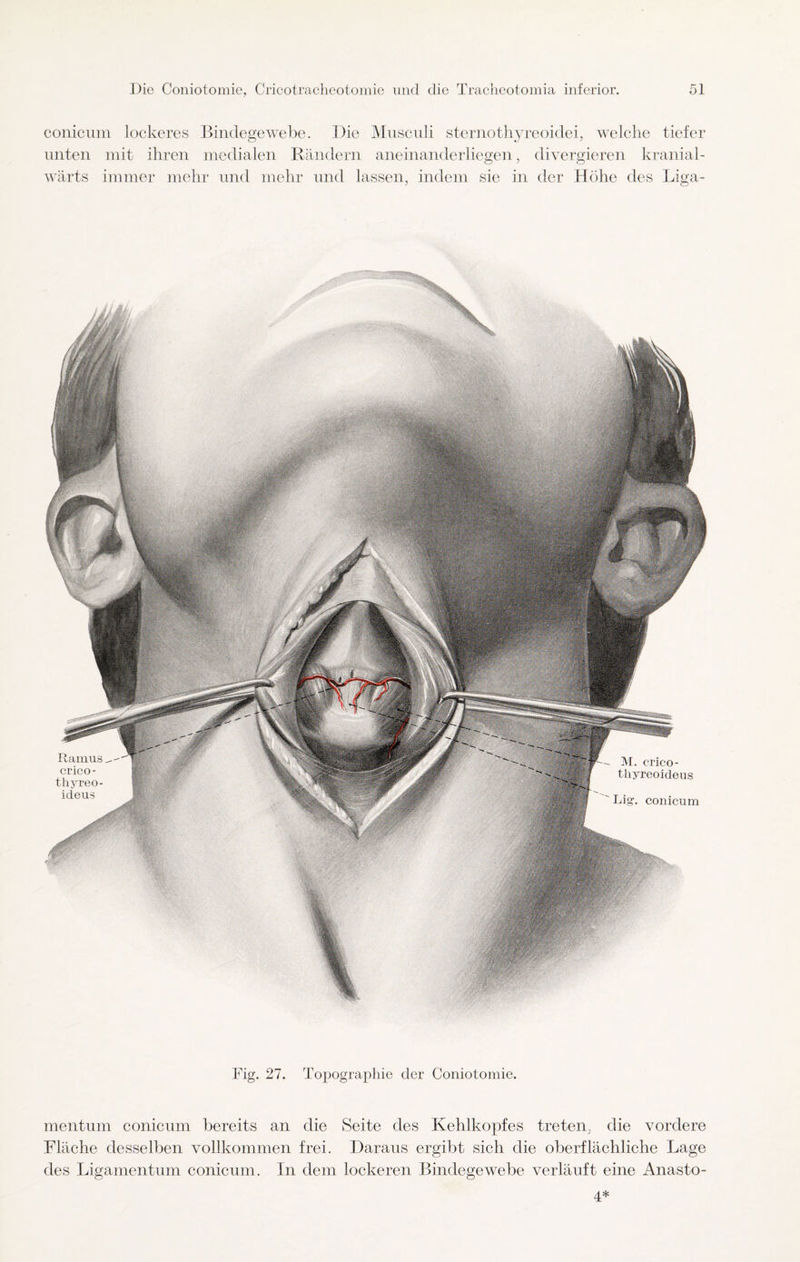 conicum lockeres Bindegewebe. Die Musculi sternothyreoidei, welche tiefer unten mit ihren medialen Rändern aneinanderliegen, divergieren kranial- wärts immer mehr und mehr und lassen, indem sie in der Höhe des Liga- Fig. 27. Topographie der Coniotomie. mentum conicum bereits an die Seite des Kehlkopfes treten, die vordere Fläche desselben vollkommen frei. Daraus ergibt sich die oberflächliche Lage des Ligamentum conicum. In dem lockeren Bindegewebe verläuft eine Anasto- 4*