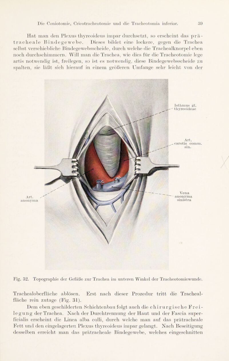 Hat man den Plexus thyreoideus impar durchsetzt, so erscheint das prä- tracheale Bindegewebe. Dieses Bildet eine lockere, gegen die Trachea selbst verschiebliche Bindegewebsscheide, durch welche die Trachealknorpel eben noch durchschimmern. Will man die Trachea, wie dies für die Tracheotomie lege artis notwendig ist, freilegen, so ist es notwendig, diese Bindegewebsscheide zu spalten, sie läßt sieh hierauf in einem größeren Umfange sehr leicht von der Art. anonyma Isthmus gl. thyreoideae Vena anonyma sinistra Art. carotis comm. sin. Fig. 32. Topographie der Gefäße zur Trachea im unteren Winkel der Tracheotomiewunde. Trachealoberflache ablösen. Erst nach dieser Prozedur tritt die Tracheal- flache rein zutage (Fig. 31). Dem eben geschilderten Schichtenbau folgt auch die chirurgische Fr ei¬ le gung der Trachea. Nach der Durchtrennung der Haut und der Fascia super¬ ficialis erscheint die Linea alba colli, durch welche man auf das prätracheale Fett und den eingelagerten Plexus thyreoideus impar gelangt. Nach Beseitigung desselben erreicht man das prätracheale Bindegewebe, welches eingeschnitten