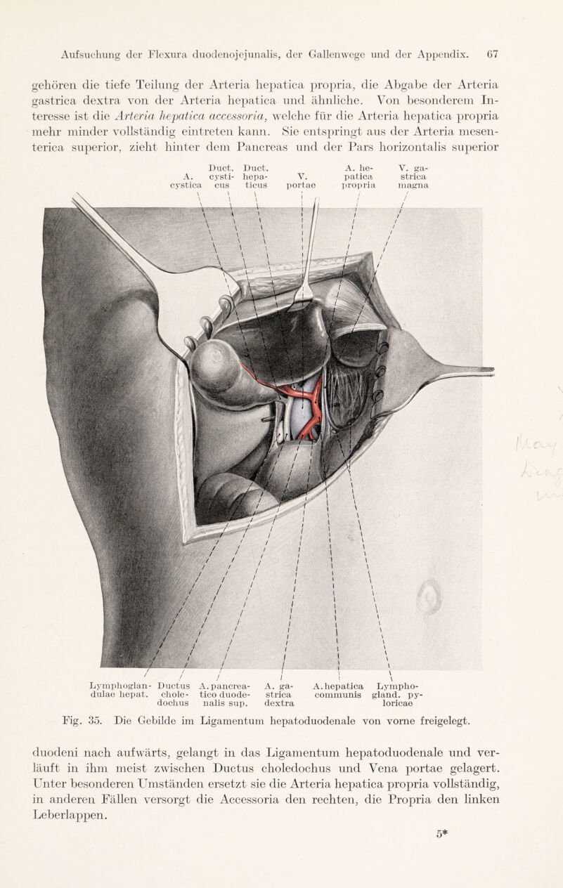 gehören die tiefe Teilung der Arteria hepatica propria, die Abgabe der Arteria gastrica dextra von der Arteria hepatica und ähnliche. Von besonderem In¬ teresse ist die Arteria hepatica accessoria, welche für die Arteria hepatica propria mehr minder vollständig eintreten kann. Sie entspringt aus der Arteria mesen- terica superior, zieht hinter dem Pancreas und der Pars horizontalis superior Duct. Duct. A. he- V. ga- A. cysti- hepa- V. patica strica cystica cus ticus portae propria magna i 1 1 V Lymphoglan- Ductus A.pancrea- A. _ga- A.hepatica Lympho- dulae hepat. chole- tico duode- strica communis gland. py- dochus nalis sup. dextra loricae Fig. 35. Pie Gebilde im Ligamentum hepatoduoclenale von vorne freigelegt. duodeni nach aufwärts, gelangt in das Ligamentum hepatocluodenale und ver¬ läuft in ihm meist zwischen Ductus choledochus und Vena portae gelagert. Unter besonderen Umständen ersetzt sie die Arteria hepatica propria vollständig, in anderen Fällen versorgt die Accessoria den rechten, die Propria den linken Leberlappen. 5*