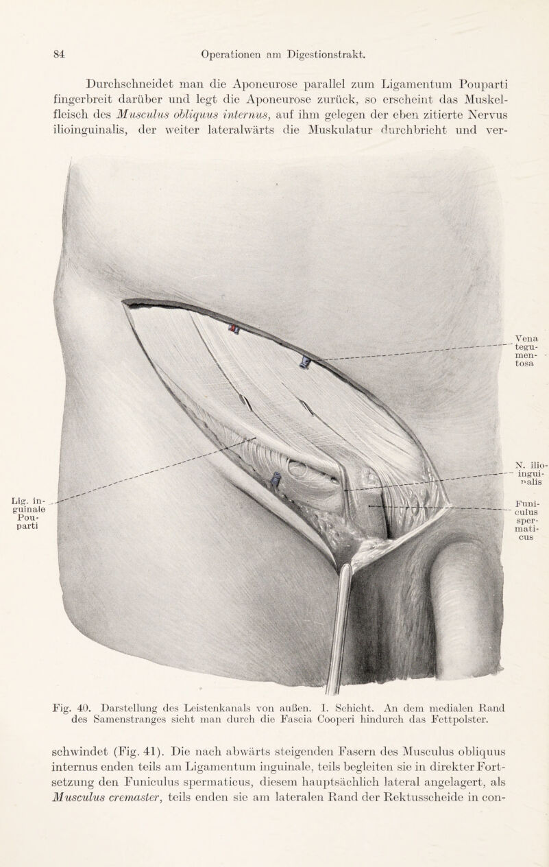 Lig. in¬ guinale Pou- parti Durchschneidet man die Aponeurose parallel zum Ligamentum Pouparti fingerbreit darüber und legt die Aponeurose zurück, so erscheint das Muskel¬ fleisch des Musculus obliquus internus, auf ihm gelegen der eben zitierte Nervus ilioinguinalis, der weiter lateralwärts die Muskulatur durchbricht und ver- Fig. 40. Darstellung des Leistenkanals von außen. I. Schicht. An dem medialen Rand des Samenstranges sieht man durch die Fascia Cooperi hindurch das Fettpolster. schwindet (Fig. 41). Die nach abwärts steigenden Fasern des Musculus obliquus internus enden teils am Ligamentum inguinale, teils begleiten sie in direkter Fort¬ setzung den Funiculus spermaticus, diesem hauptsächlich lateral angelagert, als Musculus cremaster, teils enden sie am lateralen Rand der Rektusscheide in con- Vena tegu- men- tosa N. ilio ingui- müis Funi¬ culus sper¬ mati¬