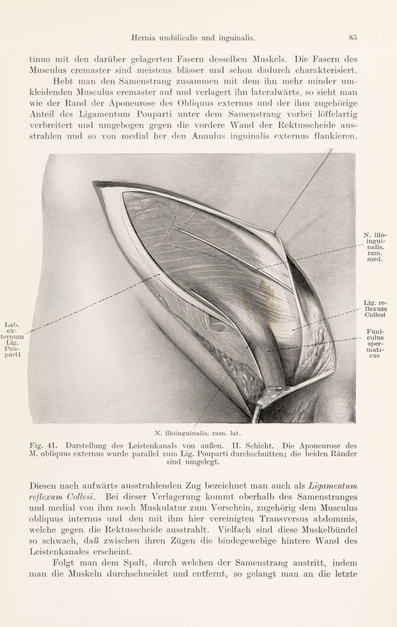 Lab. ex- ternum Lig. Pou- parti Hernia umbilicalis und inguinalis. 85 tinuo mit den darüber gelagerten Fasern desselben Muskels. Die Fasern des Muscnlus cremaster sind meistens blässer und schon dadurch charakterisiert. Hebt man den Samenstrang zusammen mit dem ihn mehr minder um¬ kleidenden Muscnlus cremaster auf und verlagert ihn lateralwärts, so sieht man wie der Rand der Aponeurose des Obliquus externus und der ihm zugehörige Anteil des Ligamentum Pouparti unter dem Samenstrang vorbei löffelartig verbreitert und umgebogen gegen die vordere Wand der Rektusscheide aus¬ strahlen und so von medial her den Annulus inguinalis externus flankieren. N. ilioinguinalis, ram. lat. Fig. 41. Darstellung des Leistenkanals von außen. II. Schicht. Die Aponeurose des M. obliquus externus wurde parallel zum Lig. Pouparti durchschnitten; die beiden Ränder sind umgelegt. Diesen nach aufwärts ausstrahlenden Zug bezeichnet man auch als Ligamentum reflexwn Collesi. Bei dieser Verlagerung kommt oberhalb des Samenstranges und medial von ihm noch Muskulatur zum Vorschein, zugehörig dem Musculus obliquus internus und den mit ihm hier vereinigten Transversus abdommis, welche gegen die Rektusscheide ausstrahlt. Vielfach sind diese Muskelbündel so schwach, daß zwischen ihren Zügen die bindegewebige hintere Wand des Leistenkanales erscheint. Folgt man dem Spalt, durch welchen der Samenstrang austritt, indem man die Muskeln durchschneidet und entfernt, so gelangt man an die letzte N. ilio¬ ingui¬ nalis. ram. med. Lig. re- flexum Collesi Funi- culus sper- mati- cus