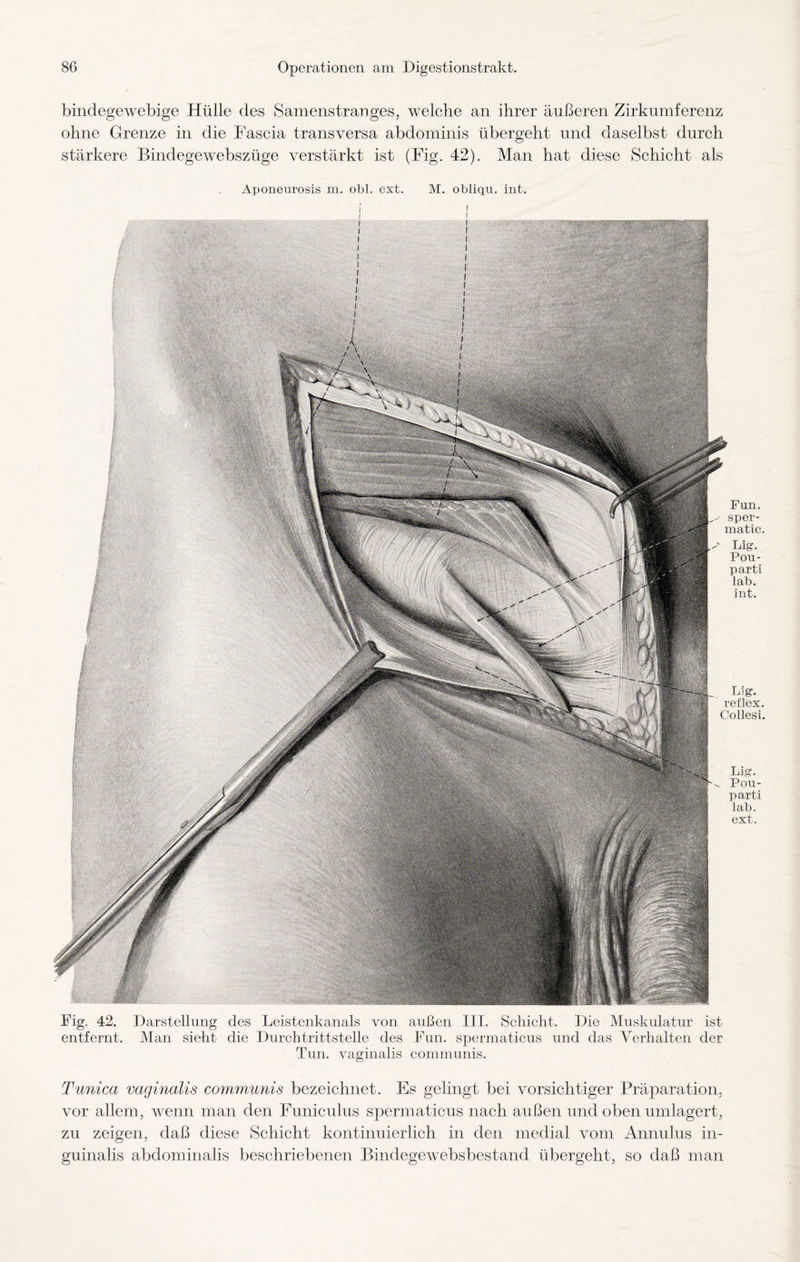 bindegewebige Hülle des Samenstranges, welche an ihrer äußeren Zirkumferenz ohne Grenze in die Fascia transversa abdominis übergeht und daselbst durch stärkere Bindegewebszüge verstärkt ist (Fig. 42). Man hat diese Schicht als Aponeurosis m. ol>l. ext. M. obliqu. int. i i i i ! I [ I I Fun. sper- matic. Lig. Pou- parti lab. int. Lig. reflex. Collesi. Lig. ^ Pou- parti lab. ext. Fig. 42. Darstellung des Leistenkanals von außen III. Schicht. Die Muskulatur ist entfernt. Man sieht die Durchtrittstelle des Fun. spermaticus und das Verhalten der Tun. vaginalis communis. Tunica vaginalis communis bezeichnet. Es gelingt bei vorsichtiger Präparation, vor allem, wenn man den Funiculus spermaticus nach außen und oben umlagert, zu zeigen, daß diese Schicht kontinuierlich in den medial vom Annulus in- guinalis abdominalis beschriebenen Bindegewebsbestand übergeht, so daß man