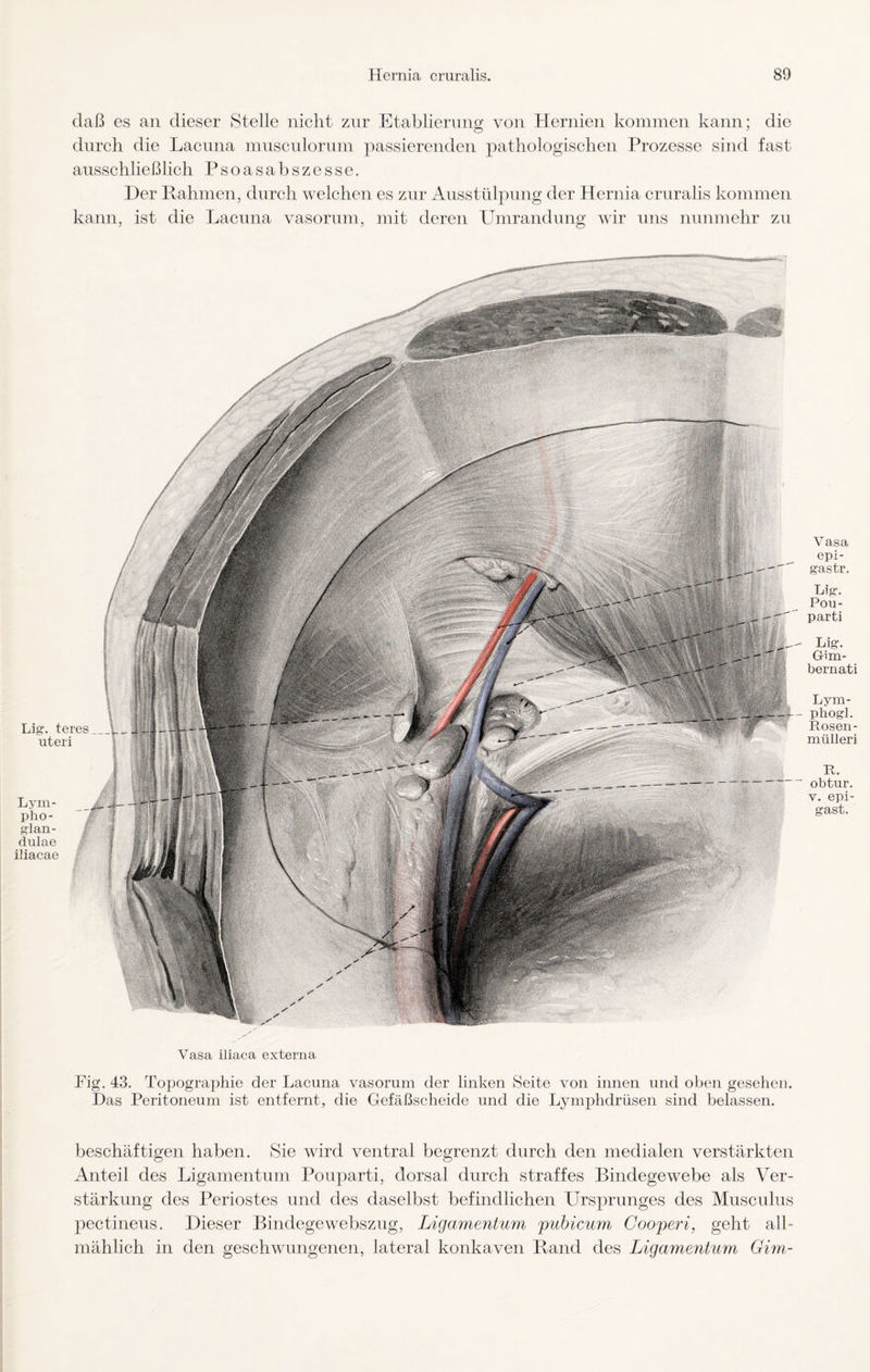 daß es an dieser Stelle nicht zur Etablierung von Hernien kommen kann; die durch die Lacuna musculoriun passierenden pathologischen Prozesse sind fast ausschließlich Psoasabszesse. Der Rahmen, durch welchen es zur Ausstülpung der Hernia cruralis kommen kann, ist die Lacuna vasorum, mit deren Umrandung wir uns nunmehr zu \ Lig. teres_l uteri Lym- pho- glan- dulae iliacae Vasa iliaca externa Fig. 43. Topographie der Lacuna vasorum der linken Seite von innen und oben gesehen. Das Peritoneum ist entfernt, die Gefäßscheide und die Lymphdrüsen sind belassen. beschäftigen haben. Sie wird ventral begrenzt durch den medialen verstärkten Anteil des Ligamentum Pouparti, dorsal durch straffes Bindegewebe als Ver¬ stärkung des Periostes und des daselbst befindlichen Ursprunges des Musculus pectineus. Dieser Bindegewebszug, Ligamentum 'pubicum Gooperi, geht all¬ mählich in den geschwungenen, lateral konkaven Rand des Ligamentum Gim- Vasa epi- gastr. Lig. Pou¬ parti Lig. Grim- bernati Lym- pliogl. Rosen- mülleri R. obtur. v. epi- gast.