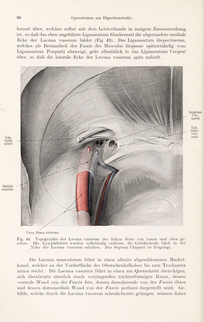 bernati über, welches selbst mit dem Leistenbande in innigem Zusammenhang ist, so daß das eben angeführte Ligamentum Gimbernati die abgerundete mediale Ecke der Lacuna vasorum bildet (Fig. 43). Das Ligamentum iliopectineum, welches als Bestandteil der Faszie des Musculus iliopsoas spitzwinkelig vom Ligamentum Pouparti abzweigt, geht allmählich in das Ligamentum Cooperi über, so daß die laterale Ecke der Lacuna vasorum spitz zuläuft. Li,2;. teres uteri Die Lacuna musculorum führt in einen allseits abgeschlossenen Muskel¬ kanal, welcher an der Vorderfläche des Oberschenkelhalses bis zum Trochanter minor reicht. Die Lacuna vasorum führt in einen am Querschnitt dreieckigen, sich dis talwärts ziemlich rasch verjüngenden trichterförmigen Raum, dessen ventrale Wand von der Fascia lala, dessen clorsolaterale von der Fascia iliaca und dessen dorsomediale Wand von der Fascia pectinea dargestellt wird. Ge¬ bilde, welche durch die Lacuna vasorum schenkelwärts gelangen, müssen daher Gefäß - sclieide Vasa iliaca externa Fig. 44. Topographie der Lacuna vasorum der linken Seite von innen und oben ge¬ sehen. Die Lymphdrüsen wurden vollständig entfernt, die Gefäßscheide blieb in der Nähe der Lacuna vasorum erhalten. Das Septum Cloqueti ist freigelegt. Septum Clo¬ queti Lig. Gim¬ ber¬ nati