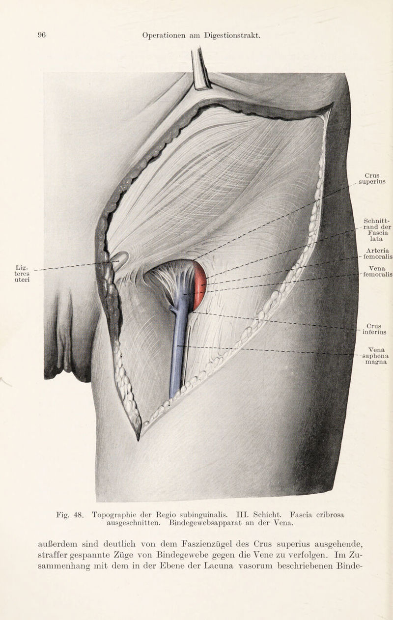 Lig. teres uteri Crus superius Schnitt¬ rand der Fascia lata Arteria femoralis Vena femoralis Crus inferius Vena -saphena magna Fig. 48. Topographie der Regio subinguinalis. III. Schicht. Fascia cribrosa ausgeschnitten. Bindegewebsapparat an der Vena. außerdem sind deutlich von dem Faszienzügel des Crus superius ausgehende, straffer gespannte Züge von Bindegewebe gegen die Vene zu verfolgen. Im Zu¬ sammenhang mit dem in der Ebene der Lacuna vasorum beschriebenen Binde-