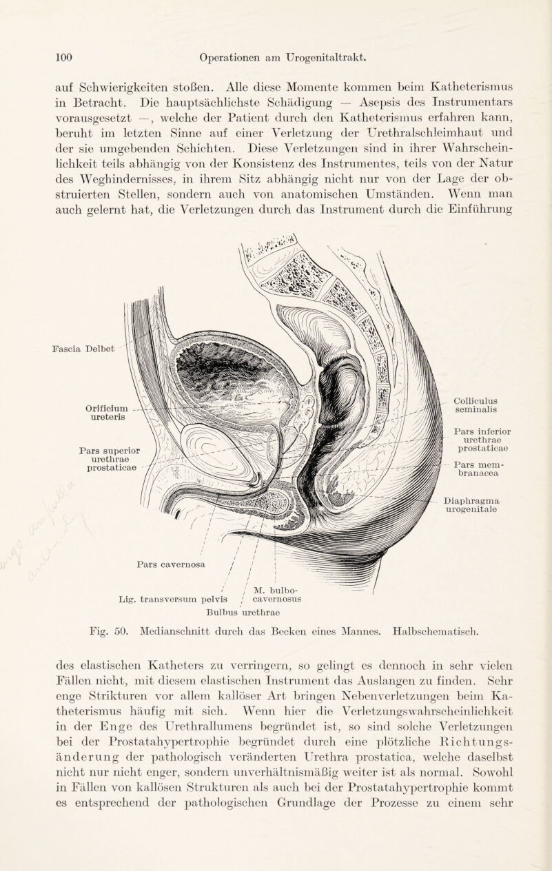 auf Schwierigkeiten stoßen. Alle diese Momente kommen beim Katheterismus in Betracht. Die hauptsächlichste Schädigung — Asepsis des Instrumentars vorausgesetzt —, welche der Patient durch den Katheterismus erfahren kann, beruht im letzten Sinne auf einer Verletzung der Urethralschleimhaut und der sie umgebenden Schichten. Diese Verletzungen sind in ihrer Wahrschein¬ lichkeit teils abhängig von der Konsistenz des Instrumentes, teils von der Natur des Weghindernisses, in ihrem Sitz abhängig nicht nur von der Lage der ob¬ struierten Stellen, sondern auch von anatomischen Umständen. Wenn man auch gelernt hat, die Verletzungen dnrch das Instrument durch die Einführung Fascia Delbet Orificium — ureteris Pars superior urethrae prostaticae Pars cavernosa Lig. transversum pelvis / cavernosus Bulbus urethrae Colliculus seminalis Pars inferior urethrae prostaticae Pars mein- branacea Diaphragma urogenitale Fig. 50. Medianschnitt durch das Becken eines Mannes. Halbschematisch. des elastischen Katheters zu verringern, so gelingt es dennoch in sehr vielen Fällen nicht, mit diesem elastischen Instrument das Auslangen zu finden. Sehr enge Strikturen vor allem kallöser Art bringen Neben Verletzungen beim Ka¬ theterismus häufig mit sich. Wenn hier die VerletzungsWahrscheinlichkeit in der Enge des Urethrallumens begründet ist, so sind solche Verletzungen bei der Prostatahypertrophie begründet durch eine plötzliche Richtungs¬ änderung der pathologisch veränderten Urethra prostatica, welche daselbst nicht nur nicht enger, sondern unverhältnismäßig weiter ist als normal. Sowohl in Fällen von kallösen Strukturen als auch bei der Prostatahypertrophie kommt es entsprechend der pathologischen Grundlage der Prozesse zu einem sehr