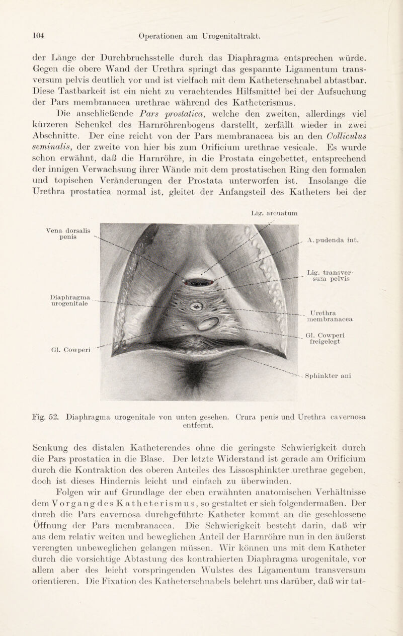 der Länge der Durchbruchsstelle durch das Diaphragma entsprechen würde. Gegen die obere Wand der Urethra springt das gespannte Ligamentum trans- versum pelvis deutlich vor und ist vielfach mit dem Katheterschnabel abtastbar. Diese Tastbarkeit ist ein nicht zu verachtendes Hilfsmittel bei der Aufsuchung der Pars membranacea urethrae während des Katheterismus. Die anschließende Pars prostatica, welche den zweiten, allerdings viel kürzeren Schenkel des Harnröhrenbogens darstellt, zerfällt wieder in zwei Abschnitte. Der eine reicht von der Pars membranacea bis an den Colliculus seminalis, der zweite von hier bis zum Orificium urethrae vesicale. Es wurde schon erwähnt, daß die Harnröhre, in die Prostata eingebettet, entsprechend der innigen Verwachsung ihrer Wände mit dem prostatischen Ring den formalen und topischen Veränderungen der Prostata unterworfen ist. Insolange die Urethra prostatica normal ist, gleitet der Anfangsteil des Katheters bei der Lig. areuatum Vena dorsalis penis Diaphragma urogenitale Gl. Cowperi „ A.pudenda int. Lig-. transver- sum pelvis Sphinkter ani Urethra membranacea Gl. Cowperi freigelegt Fig. 52. Diaphragma urogenitale von unten gesehen. Crura penis und Urethra cavernosa entfernt. Senkung des distalen Katheterendes ohne die geringste Schwierigkeit durch die Pars prostatica in die Blase. Der letzte Widerstand ist gerade am Orificium durch die Kontraktion des oberen Anteiles des Lissosphinkter urethrae gegeben, doch ist dieses Hindernis leicht und einfach zu überwinden. Folgen wir auf Grundlage der eben erwähnten anatomischen Verhältnisse dem Vorgangdes Katheterismus, so gestaltet er sich folgendermaßen. Der durch die Pars cavernosa durchgeführte Katheter kommt an die geschlossene Öffnung der Pars membranacea. Die Schwierigkeit besteht darin, daß wir aus dem relativ weiten und beweglichen Anteil der Harnröhre nun in den äußerst verengten unbeweglichen gelangen müssen. Wir können uns mit dem Katheter durch die vorsichtige Abtastung des kontrahierten Diaphragma urogenitale, vor allem aber des leicht vorspringenden Wulstes des Ligamentum transversum orientieren. Die Fixation des Katheterschnabels belehrt uns darüber, daß wir tat-