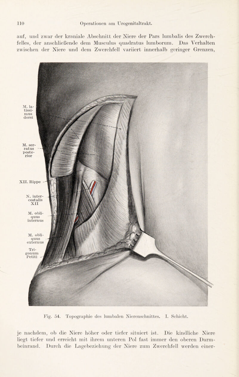 auf, und zwar der kraniale Abschnitt der Niere der Pars lumbalis des Zwerch¬ felles, der anschließende dem Musculus quadratus lumborum. Das Verhalten zwischen der Niere und dem Zwerchfell variiert innerhalb geringer Grenzen, M. la- tissi- mus dorsi M. ser- ratus — poste¬ rior XII. Rippe N. inter- costalis XII Tri- gonum Petiti V V v. Fig. 54. Topographie des lumbalen Nierenschnittes. I. Schicht. je nachdem, ob die Niere höher oder tiefer situiert ist. Die kindliche Niere liegt tiefer und erreicht mit ihrem unteren Pol fast immer den oberen Darm¬ beinrand. Durch die Lagebeziehung der Niere zum Zwerchfell werden einer-