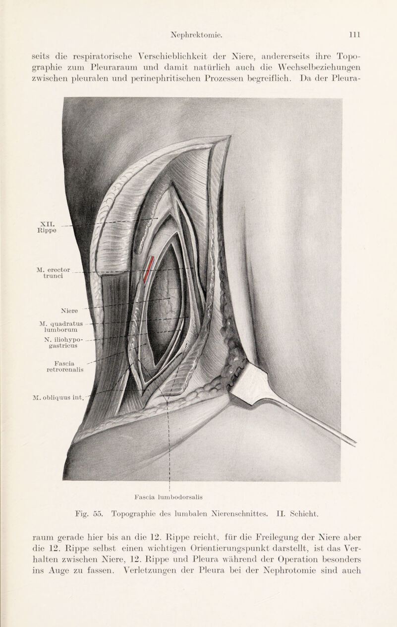 seits die respiratorische Verschieblichkeit der Niere, andererseits ihre Topo¬ graphie zum Pleuraraum und damit natürlich auch die Wechselbeziehungen zwischen pleuralen und perinephritischen Prozessen begreiflich. Da der Pleura- XII. __ Rippe M. erector trunci M. obliquus int Niere M. quadratus lumborum N. iliohypo- g'astricus Fascia retrorenalis Fascia lumbodorsalis Fig. 55. Topographie des lumbalen Nierenschnittes. II. Schicht. raum gerade hier bis an die 12. Rippe reicht, für die Freilegung der Niere aber die 12. Rippe selbst einen wichtigen Orientierungspunkt darstellt, ist das Ver¬ halten zwischen Niere, 12. Rippe und Pleura während der Operation besonders ins Auge zu fassen. Verletzungen der Pleura bei der Nephrotomie sind auch