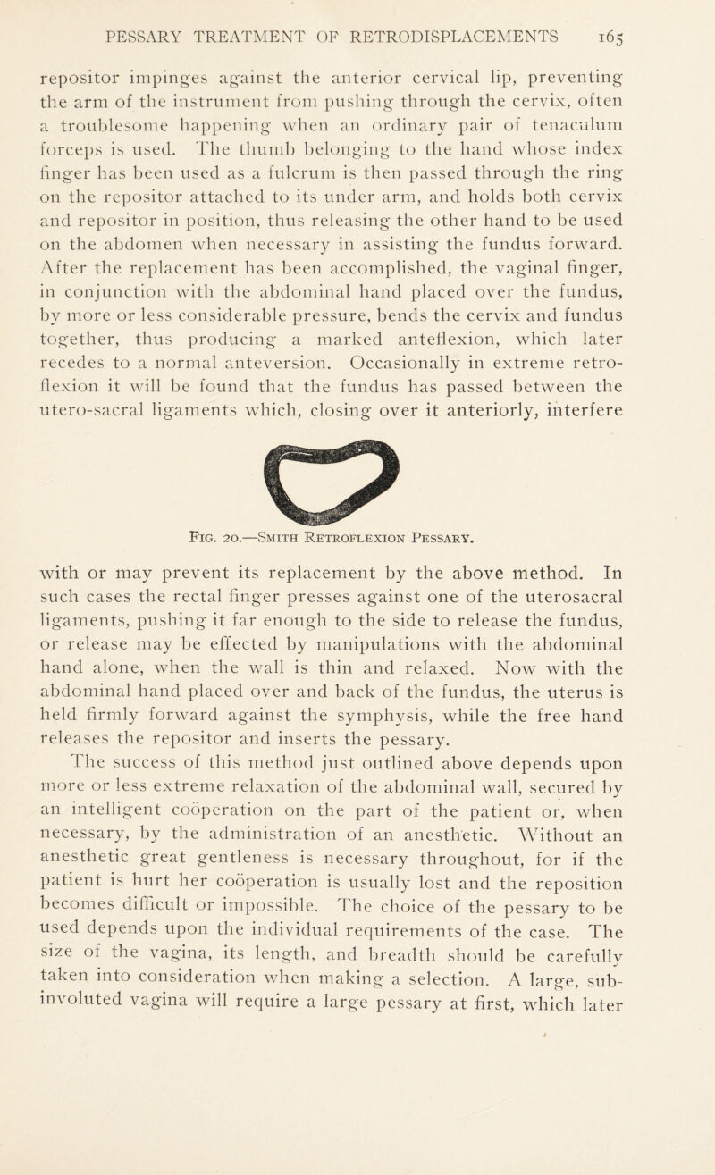 repositor impinges against the anterior cervical lip, preventing the arm of the instrument from pushing through the cervix, often a troublesome happening when an ordinary pair of tenaculum forceps is used. The thumb belonging to the hand whose index linger has been used as a fulcrum is then passed through the ring on the repositor attached to its under arm, and holds both cervix and repositor in position, thus releasing the other hand to be used on the abdomen when necessary in assisting the fundus forward. After the replacement has been accomplished, the vaginal finger, in conjunction with the abdominal hand placed over the fundus, by more or less considerable pressure, bends the cervix and fundus together, thus producing a marked anteflexion, which later recedes to a normal anteversion. Occasionally in extreme retro¬ flexion it will be found that the fundus has passed between the utero-sacral ligaments which, closing over it anteriorly, interfere Fig. 20.—Smith Retroflexion Pessary. with or may prevent its replacement by the above method. In such cases the rectal finger presses against one of the uterosacral ligaments, pushing it far enough to the side to release the fundus, or release may be effected by manipulations with the abdominal hand alone, when the wall is thin and relaxed. Now with the abdominal hand placed over and back of the fundus, the uterus is held firmly forward against the symphysis, while the free hand releases the repositor and inserts the pessary. The success of this method just outlined above depends upon more or less extreme relaxation of the abdominal wall, secured by an intelligent cooperation on the part of the patient or, when necessary, by the administration of an anesthetic. Without an anesthetic great gentleness is necessary throughout, for if the patient is hurt her cooperation is usually lost and the reposition becomes difficult or impossible. 1 he choice of the pessary to be used depends upon the individual requirements of the case. The size of the vagina, its length, and breadth should be carefully taken into consideration when making a selection. A large, sub¬ involuted vagina will require a large pessary at first, which later