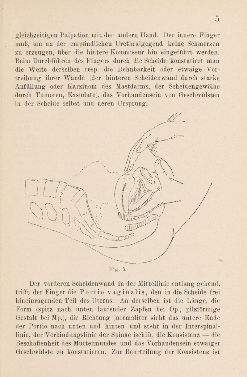 gleichzeitigen Palpation mit der andern Hand. Der innere Finger muß, um an der empfindlichen Urethralgegend keine Schmerzen zu erzeugen, über die hintere Kommissur hin ein geführt werden. Beim Durchführen des Fingers durch die Scheide konstatiert man die Weite derselben resp. die Dehnbarkeit oder etwaige Vor¬ treibung ihrer Wände (der hinteren Scheidenwand durch starke Anfüllung oder Karzinom des Mastdarms, der Scheidengewölbe durch Tumoren, Exsudate), das Vorhandensein von Geschwülsten in der Scheide selbst und deren Ursprung. Fig. 5. Der vorderen Scheidenwand in der Mittellinie entlang gehend, trifft der Finger die Portio vaginalis, den in die Scheide frei hineinragenden Teil des Uterus. An derselben ist die Länge, die Form (spitz nach unten laufender Zapfen bei Op., pilzförmige Gestalt bei Mp.), die Richtung (normaliter sieht das untere Ende der Portio nach unten und hinten und steht in der Interspinal¬ linie, der Verbindungslinie der Spinae ischii), die Konsistenz — die Beschaffenheit des Muttermundes und das Vorhandensein etwaiger Geschwülste zu konstatieren. Zur Beurteilung der Konsistenz ist