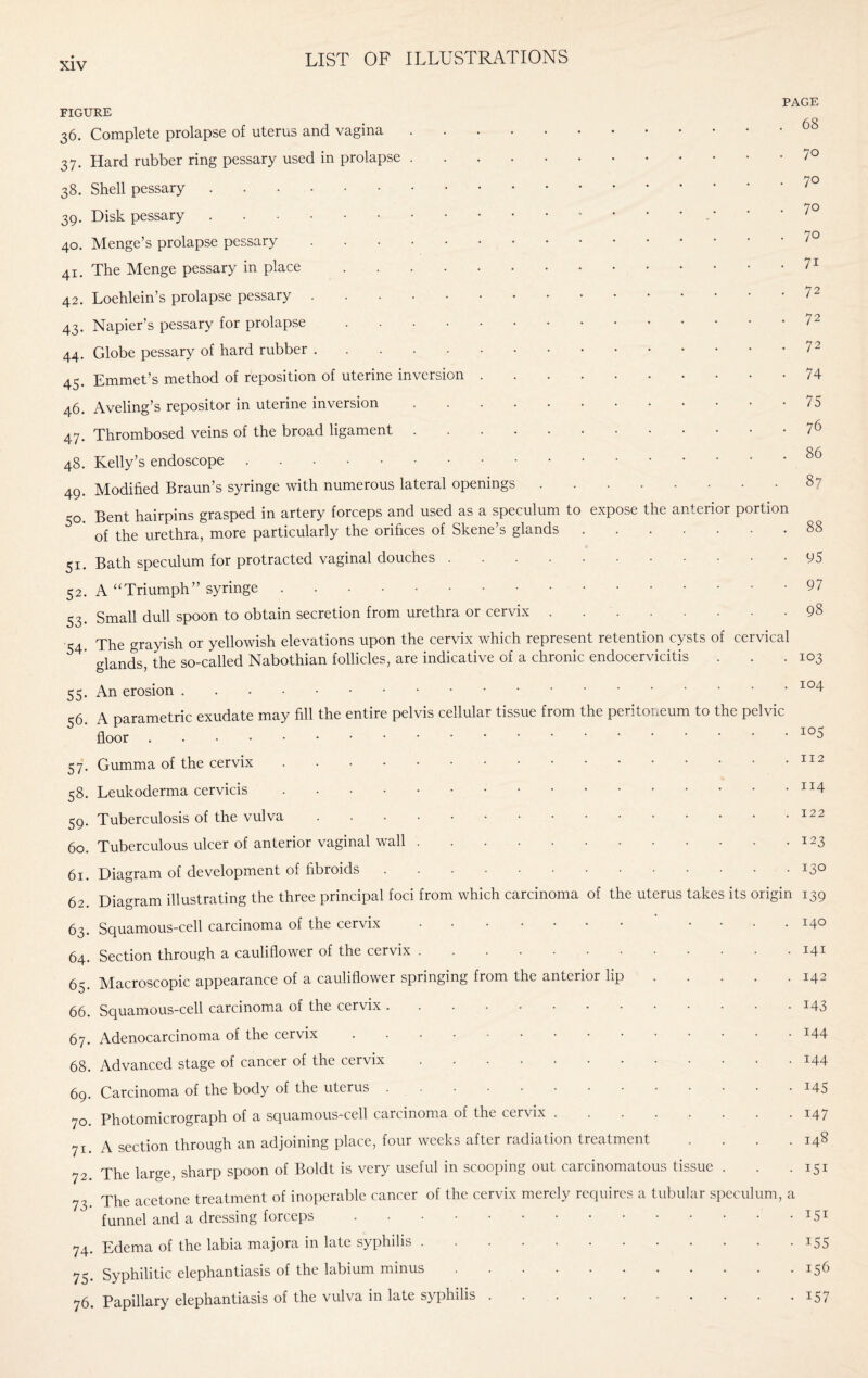 PAGE FIGURE 36. Complete prolapse of uterus and vagina.68 37. Hard rubber ring pessary used in prolapse.7° 38. Shell pessary.7° 39. Disk pessary. 7° 40. Menge’s prolapse pessary.70 41. The Menge pessary in place.71 42. Loehlein’s prolapse pessary.72 43. Napier’s pessary for prolapse.72 44. Globe pessary of hard rubber.72 45. Emmet’s method of reposition of uterine inversion.74 46. Aveling’s repositor in uterine inversion ..75 47. Thrombosed veins of the broad ligament.76 48. Kelly’s endoscope.86 49. Modified Braun’s syringe with numerous lateral openings.87 50. Bent hairpins grasped in artery forceps and used as a speculum to expose the anterior portion of the urethra, more particularly the orifices of Skene’s glands.88 51. Bath speculum for protracted vaginal douches.95 52. A “Triumph” syringe.. 53> Small dull spoon to obtain secretion from urethra or cervix.98 S4 The grayish or yellowish elevations upon the cervix which represent retention cysts of cervical ' glands, the so-called Nabothian follicles, are indicative of a chronic endocervicitis . . .103 55. An erosion.104 -5 A parametric exudate may fill the entire pelvis cellular tissue from the peritoneum to the pelvic ' floor. 57. Gumma of the cervix.112 58. Leukoderma cervicis.n4 59. Tuberculosis of the vulva.122 60. Tuberculous ulcer of anterior vaginal wall.123 61. Diagram of development of fibroids.13° 62 Diagram illustrating the three principal foci from which carcinoma of the uterus takes its origin 139 63. Squamous-cell carcinoma of the cervix. .... 140 64. Section through a cauliflower of the cervix.141 65. Macroscopic appearance of a cauliflower springing from the anterior lip.142 66. Squamous-cell carcinoma of the cervix.143 67. Adenocarcinoma of the cervix.144 68. Advanced stage of cancer of the cervix.144 69. Carcinoma of the body of the uterus ..145 70. Photomicrograph of a squamous-cell carcinoma of the cervix.147 71 A section through an adjoining place, lour weeks after radiation treatment .... 148 72 The large, sharp spoon of Boldt is very useful in scooping out carcinomatous tissue . . .151 73 The acetone treatment of inoperable cancer of the cervix merely requires a tubular speculum, a funnel and a dressing forceps.151 74. Edema of the labia majora in late syphilis.155 75- Syphilitic elephantiasis of the labium minus.156 76. Papillary elephantiasis of the vulva in late syphilis.157