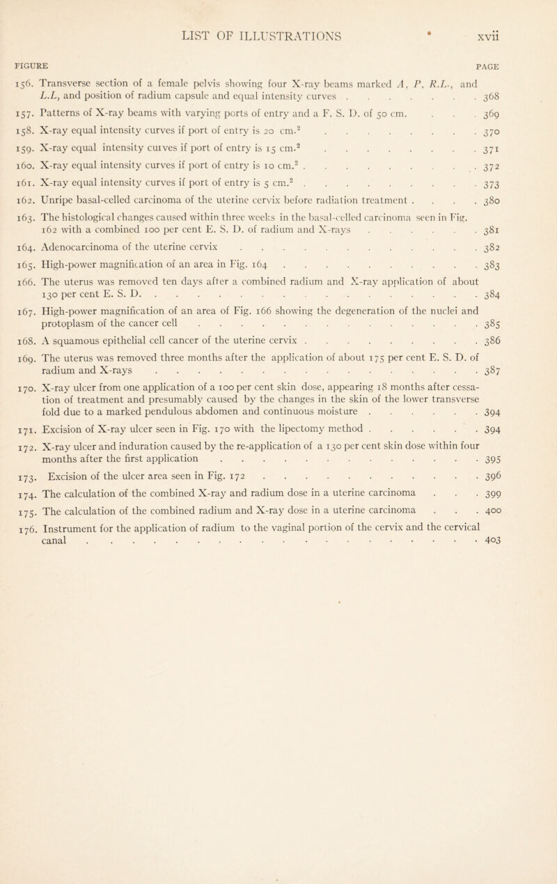 FIGURE PAGE 156. Transverse section of a female pelvis showing four X-ray beams marked A, P, R.L-, and L.L, and position of radium capsule and equal intensity curves.368 157. Patterns of X-ray beams with varying ports of entry and a F. S. D. of 50 cm. . . . 369 158. X-ray equal intensity curves if port of entry is 20 cm.2.370 159. X-ray equal intensity cuives if port of entry is 15 cm.2.371 160. X-ray equal intensity curves if port of entry is 10 cm.2.. . .372 161. X-ray equal intensity curves if port of entry is 5 cm.2.373 162. Unripe basal-celled carcinoma of the uterine cervix before radiation treatment .... 380 163. The histological changes caused within three weeks in the basal-celled carcinoma seen in Fig. 162 with a combined 100 per cent E. S. D. of radium and X-rays.381 164. Adenocarcinoma of the uterine cervix.382 165. High-power magnification of an area in Fig. 164.383 166. The uterus was removed ten days after a combined radium and X-ray application of about 130 per cent E. S. D.384 167. High-power magnification of an area of Fig. 166 showing the degeneration of the nuclei and protoplasm of the cancer cell.385 168. A squamous epithelial cell cancer of the uterine cervix ..386 169. The uterus was removed three months after the application of about 175 per cent E. S. D. of radium and X-rays.387 170. X-ray ulcer from one application of a 100 per cent skin dose, appearing 18 months after cessa¬ tion of treatment and presumably caused by the changes in the skin of the lower transverse fold due to a marked pendulous abdomen and continuous moisture.394 171. Excision of X-ray ulcer seen in Fig. 170 with the lipectomy method.394 172. X-ray ulcer and induration caused by the re-application of a 130 per cent skin dose within four months after the first application.395 173. Excision of the ulcer area seen in Fig. 172.396 174. The calculation of the combined X-ray and radium dose in a uterine carcinoma . . . 399 175. The calculation of the combined radium and X-ray dose in a uterine carcinoma . . . 400 176. Instrument for the application of radium to the vaginal portion of the cervix and the cervical canal ..403