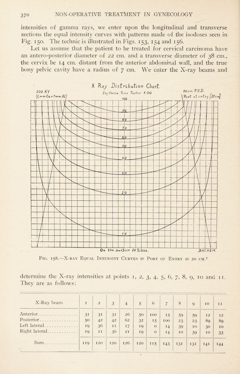 intensities of gamma rays, we enter upon the longitudinal and transverse sections the equal intensity curves with patterns made of the isodoses seen in Fig. 150. The technic is illustrated in Figs. 153, 154 and 156. Let us assume that the patient to be treated for cervical carcinoma have an antero-posterior diameter of 22 cm. and a transverse diameter of 38 cm., the cervix be 14 cm. distant from the anterior abdominal wall, and the true bony pelvic cavity have a radius of 7 cm. We enter the X-ray beams and determine the X-ray intensities at points 1, 2, 3, 4, 5, 6, 7, 8, 9, 10 and 11. Thev are as follows: j X-Ray beam 1 2 3 4 5 6 7 8 9 10 11 Anterior. 3i 3i 3i 26 50 100 15 59 59 12 12 Posterior. 50 42 42 62 32 15 100 23 23 89 89 Left lateral. 19 36 11 17 19 0 14 39 10 30 10 Right lateral. 19 11 36 21 19 0 14 10 39 10 33 Sum. 119 120 120 126 120 115 M3 131 131 141 144