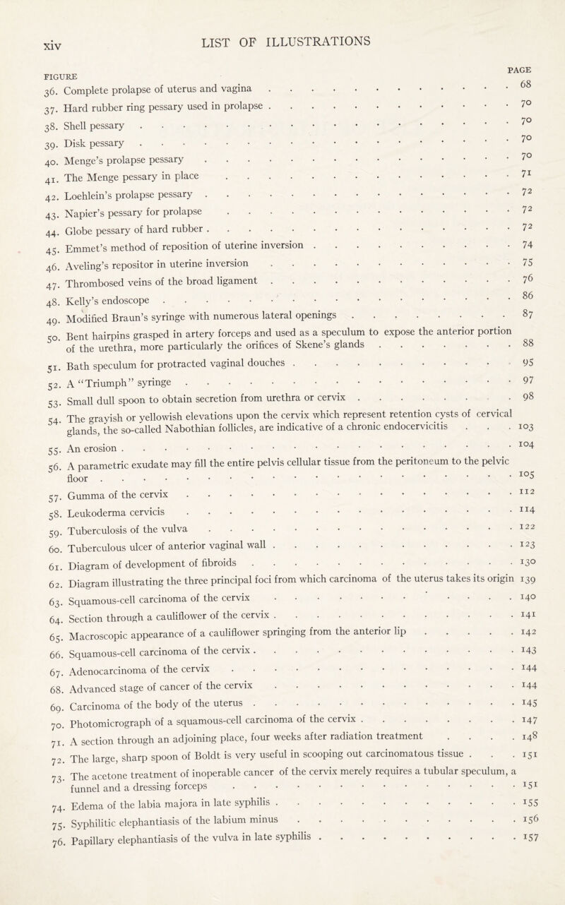 PAGE FIGURE 36. Complete prolapse of uterus and vagina.68 37. Hard rubber ring pessary used in prolapse.70 70 38. Shell pessary. 39. Disk pessary.7° 40. Menge’s prolapse pessary.70 41. The Menge pessary in place.71 42. Loehlein’s prolapse pessary.72 43. Napier’s pessary for prolapse.72 44. Globe pessary of hard rubber ..72 45. Emmet’s method of reposition of uterine inversion.74 46. Aveling’s repositor in uterine inversion.-75 47. Thrombosed veins of the broad ligament.76 48. Kelly’s endoscope..86 49. Modified Braun’s syringe with numerous lateral openings.87 50. Bent hairpins grasped in artery forceps and used as a speculum to expose the anterior portion 5 of the urethra, more particularly the orifices of Skene’s glands.88 51. Bath speculum for protracted vaginal douches. 95 52. A “Triumph” syringe.. 53. Small dull spoon to obtain secretion from urethra or cervix. .98 S4 The grayish or yellowish elevations upon the cervix which represent retention cysts of cervical * glands, the so-called Nabothian follicles, are indicative of a chronic endocervicitis . . .103 55. An erosion.’ 104 <6 A parametric exudate may fill the entire pelvis cellular tissue from the peritoneum to the pelvic ‘ floor.IOS 57. Gumma of the cervix ................ 112 58. Leukoderma cervicis.“4 59. Tuberculosis of the vulva. 122 60. Tuberculous ulcer of anterior vaginal wall.123 61. Diagram of development of fibroids ............. 13° 62 Diagram illustrating the three principal foci from which carcinoma of the uterus takes its origin 139 63. Squamous-cell carcinoma of the cervix. .... 140 64. Section through a cauliflower of the cervix.141 65. Macroscopic appearance of a cauliflower springing from the anterior lip.142 66. Squamous-cell carcinoma of the cervix.143 67. Adenocarcinoma of the cervix.* * I44 68. Advanced stage of cancer of the cervix ..144 69. Carcinoma of the body of the uterus . • • • • • • * * * * * • J45 70. Photomicrograph of a squamous-cell carcinoma of the cervix.147 71. A section through an adjoining place, four weeks after radiation treatment .... 148 7- The large, sharp spoon of Boldt is very useful in scooping out carcinomatous tissue . . . 151 73 The acetone treatment of inoperable cancer of the cervix merely requires a tubular speculum, a funnel and a dressing forceps . • • • • • • • • • • • • •I5I 74. Edema of the labia majora in late syphilis ............ 155 75- Syphilitic elephantiasis of the labium minus . ..156 76. Papillary elephantiasis of the vulva in late syphilis . ... . • T57