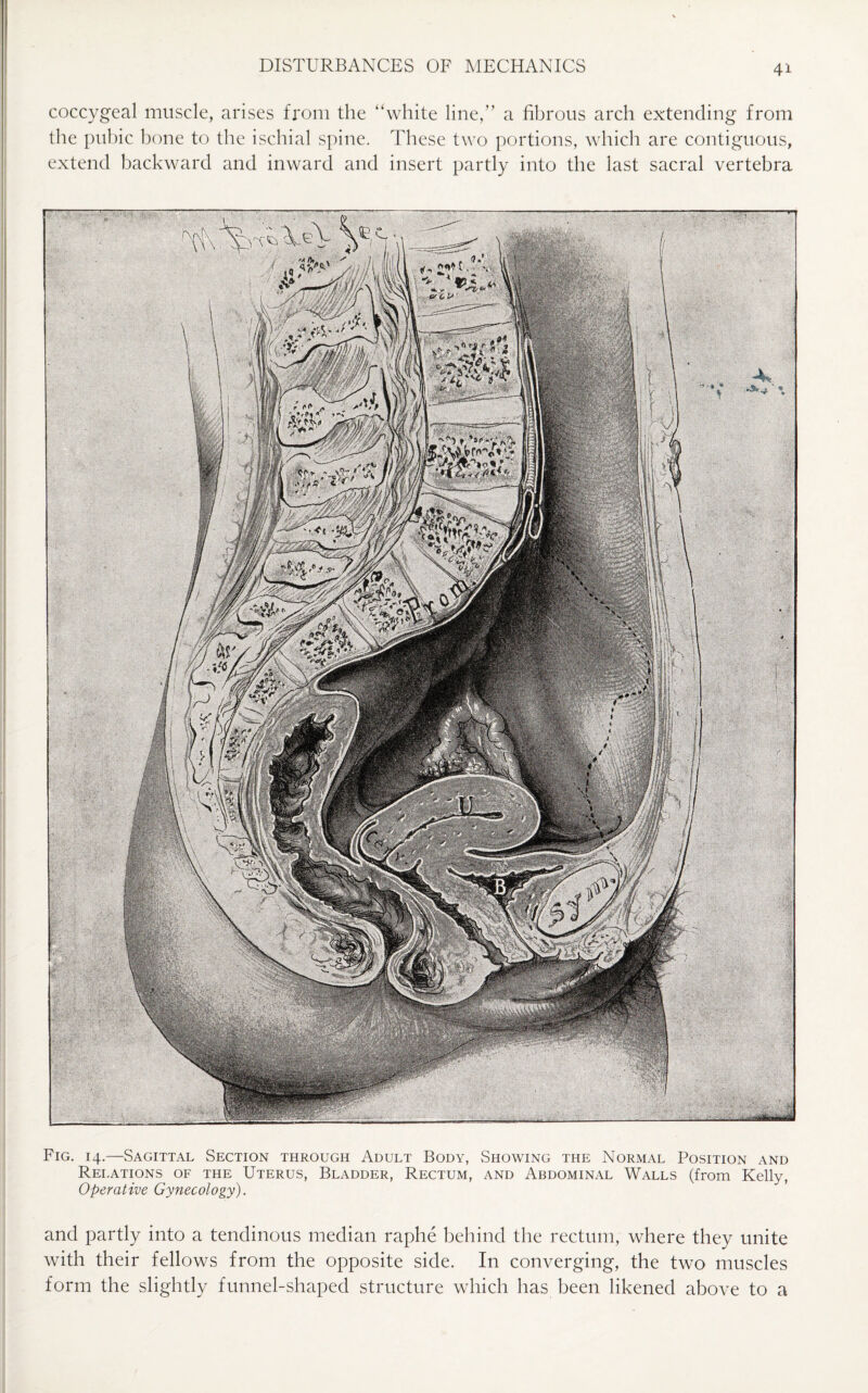 coccygeal muscle, arises from the “white line,” a fibrous arch extending from the pubic bone to the ischial spine. These two portions, which are contiguous, extend backward and inward and insert partly into the last sacral vertebra m ■<* * 4, * .. 11 ■■■■ ■■ ■ ■ 11 Fig. 14.—Sagittal Section through Adult Body, Showing the Normal Position and Relations of the Uterus, Bladder, Rectum, and Abdominal Walls (from Kelly, Operative Gynecology). and partly into a tendinous median raphe behind the rectum, where they unite with their fellows from the opposite side. In converging, the two muscles form the slightly funnel-shaped structure which has been likened above to a