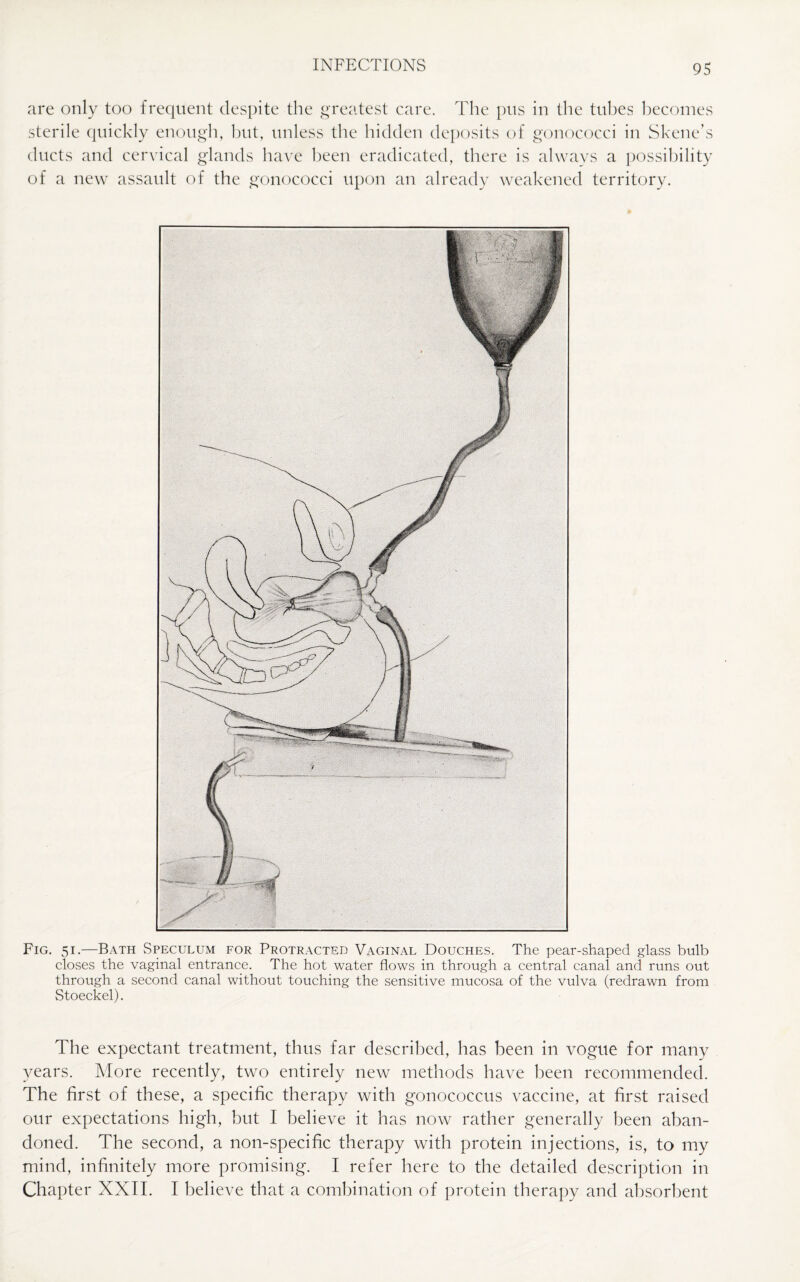 are only too frequent despite the greatest care. The pus in the tubes becomes sterile quickly enough, but, unless the hidden deposits of gonococci in Skene’s ducts and cervical glands have been eradicated, there is always a possibility of a new assault of the gonococci upon an already weakened territory. Fig. 51.—Bath Speculum for Protracted Vaginal Douches. The pear-shaped glass bulb closes the vaginal entrance. The hot water flows in through a central canal and runs out through a second canal without touching the sensitive mucosa of the vulva (redrawn from Stoeckel). The expectant treatment, thus far described, has been in vogue for many years. More recently, two entirely new methods have been recommended. The first of these, a specific therapy with gonococcus vaccine, at first raised our expectations high, but I believe it has now rather generally been aban¬ doned. The second, a non-specific therapy with protein injections, is, to my mind, infinitely more promising. I refer here to the detailed description in Chapter XXII. I believe that a combination of protein therapy and absorbent