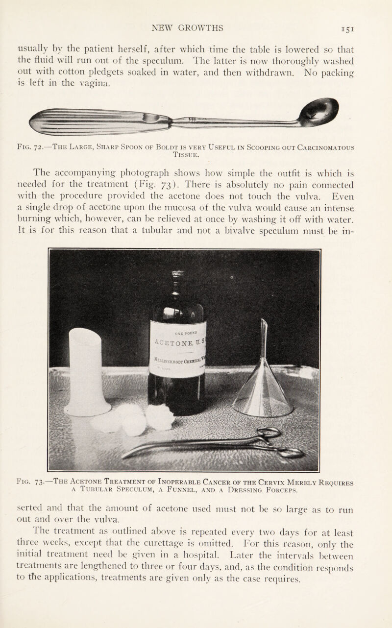 usually by the patient herself, after which time the table is lowered so that the fluid will run out of the speculum. The latter is now thoroughly washed out with cotton pledgets soaked in water, and then withdrawn. No packing is left in the vagina. Fig. 72.—The Large, Sharp Spoon of Boldt is very Useful in Scooping out Carcinomatous Tissue. The accompanying photograph shows how simple the outfit is which is needed for the treatment (Fig. 73). There is absolutely no pain connected with the procedure provided the acetone does not touch the vulva. Even a single drop of acetone upon the mucosa of the vulva would cause an intense burning which, however, can be relieved at once by washing it off with water. It is for this reason that a tubular and not a bivalve speculum must be in- Fig. 73.—The Acetone Treatment of Inoperable Cancer of the Cervix Merely Requires a Tubular Speculum, a Funnel, and a Dressing Forceps. serted and that the amount of acetone used must not be so large as to run out and over the vulva. J he treatment as outlined above is repeated every two days for at least three weeks, except that the curettage is omitted. For this reason, only the initial treatment need be given in a hospital. Later the intervals between treatments are lengthened to three or four days, and, as the condition responds to the applications, treatments are given only as the case requires.