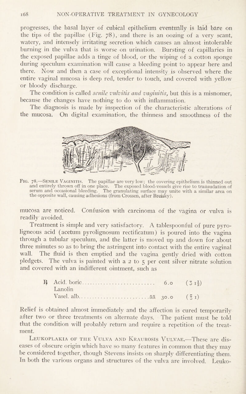 progresses, the basal layer of cubical epithelium eventually is laid bare on the tips of the papillae (big. 78), and there is an oozing of a very scant, watery, and intensely irritating secretion which causes an almost intolerable burning in the vulva that is worse on urination. Bursting of capillaries in the exposed papillae adds a tinge of blood, or the wiping of a cotton sponge during speculum examination will cause a bleeding point to appear here and there. Now and then a case of exceptional intensity is observed where the entire vaginal mucosa is deep red, tender to touch, and covered with yellow or bloody discharge. The condition is called senile vulvitis and vaginitis, but this is a misnomer, because the changes have nothing to do with inflammation. The diagnosis is made by inspection of the characteristic alterations of the mucosa. On digital examination, the thinness and smoothness of the Fig. 78.—Senile Vaginitis. The papillae are very low; the covering epithelium is thinned out and entirely thrown off in one place. The exposed blood-vessels give rise to transudation of serum and occasional bleeding. The granulating surface may unite with a similar area on the opposite wall, causing adhesions (from Crossen, after Breisky). mucosa are noticed. Confusion with carcinoma of the vagina or vulva is readily avoided. Treatment is simple and very satisfactory. A tablespoonful of pure pyro¬ ligneous acid (acetum pyrolignosum rectificatum) is poured into the vagina through a tubular speculum, and the latter is moved up and down for about three minutes so as to bring the astringent into contact with the entire vaginal wall. The fluid is then emptied and the vagina gently dried with cotton pledgets. The vulva is painted with a 2 to 5 per cent silver nitrate solution and covered with an indifferent ointment, such as by Acid, boric. 6.0 (3 i|) Lanolin Vasel. alb.aa 30.0 ( § 1) Relief is obtained almost immediately and the affection is cured temporarily after two or three treatments on alternate days. The patient must be told that the condition will probably return and require a repetition of the treat¬ ment. Leukoplakia of the Vulva and Kraurosis Vulvae.—These are dis¬ eases of obscure origin which have so many features in common that they may he considered together, though Stevens insists on sharply differentiating them. In both the various organs and structures of the vulva are involved. Leuko-
