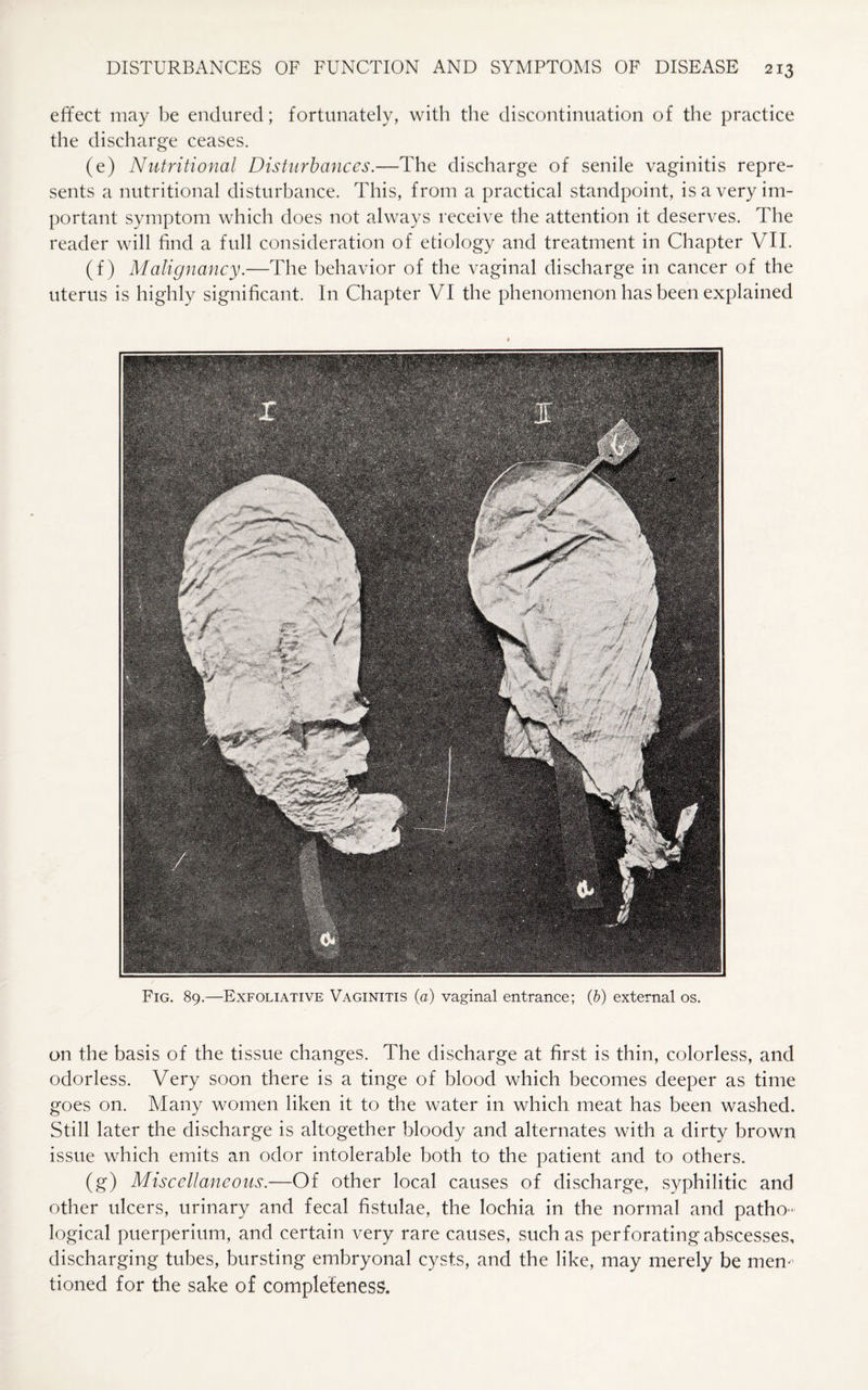 effect may be endured; fortunately, with the discontinuation of the practice the discharge ceases. (e) Nutritional Disturbances.—The discharge of senile vaginitis repre¬ sents a nutritional disturbance. This, from a practical standpoint, is a very im¬ portant symptom which does not always receive the attention it deserves. The reader will find a full consideration of etiology and treatment in Chapter VII. (f) Malignancy.—The behavior of the vaginal discharge in cancer of the uterus is highly significant. In Chapter VI the phenomenon has been explained Fig. 89.—Exfoliative Vaginitis (a) vaginal entrance; (6) external os. on the basis of the tissue changes. The discharge at first is thin, colorless, and odorless. Very soon there is a tinge of blood which becomes deeper as time goes on. Many women liken it to the water in which meat has been washed. Still later the discharge is altogether bloody and alternates with a dirty brown issue which emits an odor intolerable both to the patient and to others. (g) Miscellaneous.—Of other local causes of discharge, syphilitic and other ulcers, urinary and fecal fistulae, the lochia in the normal and patho¬ logical puerperium, and certain very rare causes, such as perforating abscesses, discharging tubes, bursting embryonal cysts, and the like, may merely be men¬ tioned for the sake of completeness.