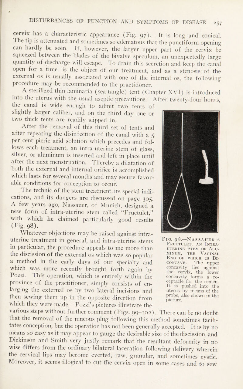cervix has a characteristic appearance (Fig. 97). It is long and conical. The tip is attenuated and sometimes so edematous that the punctiform opening can hardly be seen. If, however, the larger upper part of the cervix be squeezed betw een the blades of the bivalve speculum, an unexpectedly large quantity of discharge will escape. T o drain this secretion and keep the canal open for a time is the object of our treatment, and as a stenosis of the external os is usually associated with one of the internal os, the following procedure may be recommended to the practitioner. A sterilized thin laminaria (sea tangle) tent (Chapter XVI) is introduced into the uterus with the usual aseptic precautions. After twenty-four hours, the canal is wide enough to admit two tents of slightly larger caliber, and on the third day one or two thick tents are readily slipped in. After the removal of this third set of tents and after repeating the disinfection of the canal with a 5 per cent picric acid solution which precedes and fol¬ lows each treatment, an intra-uterine stem of glass, silver, or aluminum is inserted and left in place until after the next menstruation, d hereby a dilatation of both the external and internal orifice is accomplished which lasts for several months and may secure favor¬ able conditions for conception to occur. 1 he technic of the stem treatment, its special indi¬ cations, and its dangers are discussed on page 305. A few years ago, Nassauer, of Munich, designed a new form of intra-uterine stem called “Fructulet,” with which he claimed particularly good results (Fig. 98). Whatever objections may be raised against intra¬ uterine treatment in general, and intra-uterine stems in particular, the procedure appeals to me more than the discission of the external os which was so popular a method in the early days of our specialtv and which was more recently brought forth again bv Pozzi. This operation, which is entirely within the province of the practitioner, simply consists of en- larging the external os by two lateral incisions and then sewing them up in the opposite direction from which they were made. Pozzi’s pictures illustrate the various steps without further comment (Figs. 99-102). There can he no doubt that the removal of the mucous plug following this method sometimes facili¬ tates conception, but the operation has not been generally accepted. It is by no means so easy as it may appear to gauge the desirable size of the discission, and Dickinson and Smith very justly remark that the resultant deformity in no wise differs from the ordinary bilateral laceration following delivery wherein the cervical lips may become everted, raw, granular, and sometimes cystic. Moreover, it seems illogical to cut the cervix open in some cases and to sew Fig. 98.—Nassauer’s Fructulet, an Intra¬ uterine Stem of Alu¬ minum, the Vaginal End of which is Bi¬ concave. The upper concavity lies against the cervix, the lower concavity forms a re¬ ceptacle for the semen. It is pushed into the uterus by means of the probe, also shown in the picture.