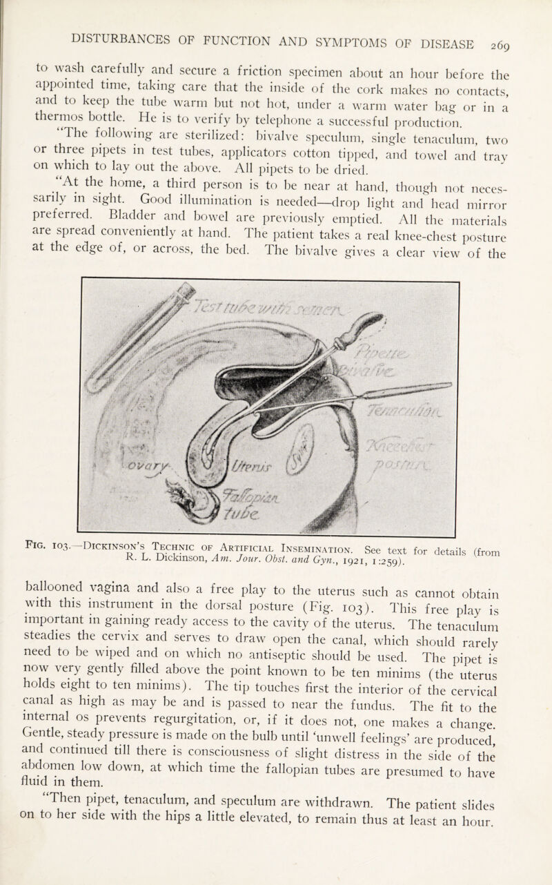 to wash carefully and secure a friction specimen about an hour before the appointed time, taking care that tiie inside of the cork makes no contacts, and to keep the tube warm but not hot, under a warm water bag or in a thermos bottle. He is to verify by telephone a successful production. The following are sterilized: bivalve speculum, single tenaculum, two or three pipets in test tubes, applicators cotton tipped, and towel and trav on which to lay out the above. All pipets to be dried. “At the home, a third person is to be near at hand, though not neces¬ sarily in sight. Good illumination is needed—drop light and head mirror preferred. Bladder and bowel are previously emptied. All the materials are spread conveniently at hand. The patient takes a real knee-chest posture at the edge of, or across, the bed. The bivalve gives a clear view of the Fig. 103. -Dickinson's Technic of Artificial Insemination. See text for details (from R. L. Dickinson, Am. Jour. Obst. and Gyn., 1921, 1:259). ballooned vagina and also a free play to the uterus such as cannot obtain with this instrument in the dorsal posture (Fig. 103). This free play is important in gaining ready access to the cavity of the uterus. The tenaculum steadies the cervix and serves to draw open the canal, which should rarely need to be wiped and on which no antiseptic should be used. The pipet is now very gently filled above the point known to be ten minims (the uterus holds eight to ten minims). The tip touches first the interior of the cervical canal as high as may be and is passed to near the fundus. The fit to the internal os prevents regurgitation, or, if it does not, one makes a change Gentle, steady pressure is made on the bulb until ‘unwell feelings’ are produced, and continued till there is consciousness of slight distress in the side of the abdomen low down, at which time the fallopian tubes are presumed to have fluid in them. “Then pipet, tenaculum, and speculum are withdrawn. The patient slides on to her side with the hips a little elevated, to remain thus at least an hour.