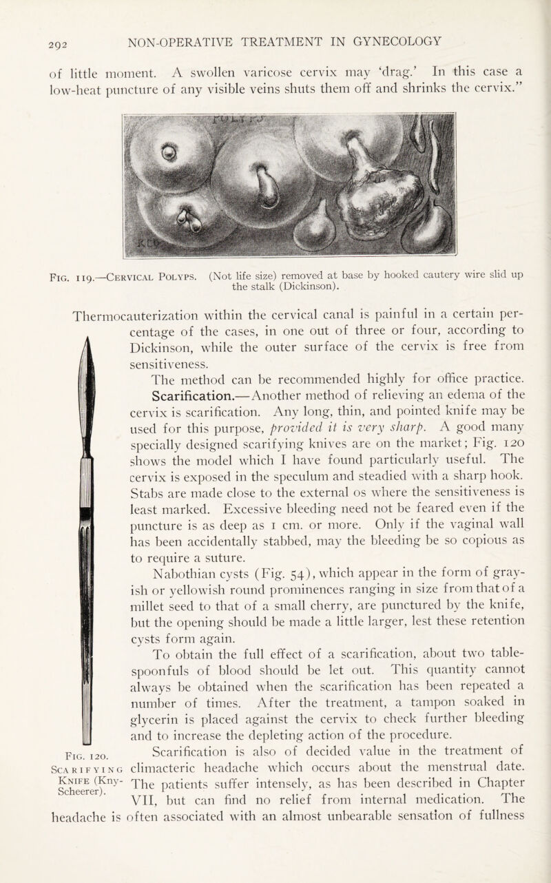 of little moment. A swollen varicose cervix may ‘drag.’ In this case a low-heat puncture of any visible veins shuts them off and shrinks the cervix.” Fig. i 19.—Cervical Polyps. (Not life size) removed at base by hooked cautery wire slid up the stalk (Dickinson). Thermocauterization within the cervical canal is painful in a certain per¬ centage of the cases, in one out of three or four, according to Dickinson, while the outer surface of the cervix is free from sensitiveness. The method can he recommended highly for office practice. Scarification.— Another method of relieving an edema of the cervix is scarification. Any long, thin, and pointed knife may be used for this purpose, provided it is very sharp. A good many specially designed scarifying knives are on the market; Fig. 120 shows the model which I have found particularly useful. The cervix is exposed in the speculum and steadied with a sharp hook. Stabs are made close to the external os where the sensitiveness is least marked. Excessive bleeding need not be feared even if the puncture is as deep as 1 cm. or more. Only if the vaginal wall has been accidentally stabbed, may the bleeding be so copious as to require a suture. Nabothian cysts (Fig. 54), which appear in the form of gray¬ ish or yellowish round prominences ranging in size from that of a millet seed to that of a small cherry, are punctured by the knife, but the opening should be made a little larger, lest these retention cysts form again. To obtain the full effect of a scarification, about two table¬ spoonfuls of blood should be let out. This quantity cannot always he obtained when the scarification has been repeated a number of times. After the treatment, a tampon soaked in glycerin is placed against the cervix to check further bleeding and to increase the depleting action of the procedure. Scarification is also of decided value in the treatment of Scarifying climacteric headache which occurs about the menstrual date. Scheerer^ny The patients suffer intensely, as has been described in Chapter VII, hut can find no relief from internal medication. The headache is often associated with an almost unbearable sensation of fullness Fig. 120.