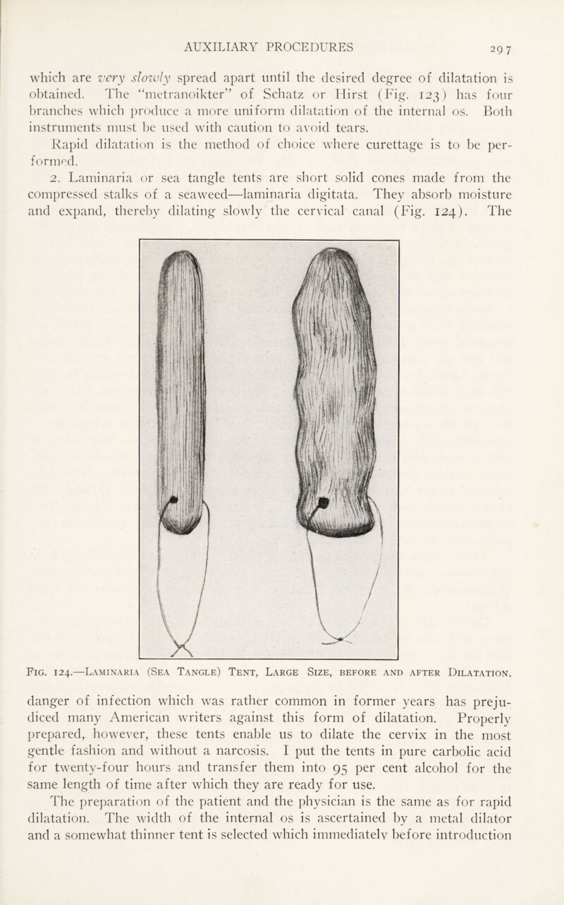which are very slowly spread apart until the desired degree of dilatation is obtained. The “metranoikter” of Schatz or Hirst (Fig. 123) has four branches which produce a more uniform dilatation of the internal os. Both instruments must be used with caution to avoid tears. Rapid dilatation is the method of choice where curettage is to be per¬ formed. 2. Laminaria or sea tangle tents are short solid cones made from the compressed stalks of a seaweed—laminaria digitata. They absorb moisture and expand, thereby dilating slowly the cervical canal (Fig. 124). The Fig. 124.—Laminaria (Sea Tangle) Tent, Large Size, before and after Dilatation. danger of infection which was rather common in former years has preju¬ diced many American writers against this form of dilatation. Properly prepared, however, these tents enable us to dilate the cervix in the most gentle fashion and without a narcosis. I put the tents in pure carbolic acid for twenty-four hours and transfer them into 95 per cent alcohol for the same length of time after which they are ready for use. The preparation of the patient and the physician is the same as for rapid dilatation. The width of the internal os is ascertained by a metal dilator and a somewhat thinner tent is selected which immediatelv before introduction