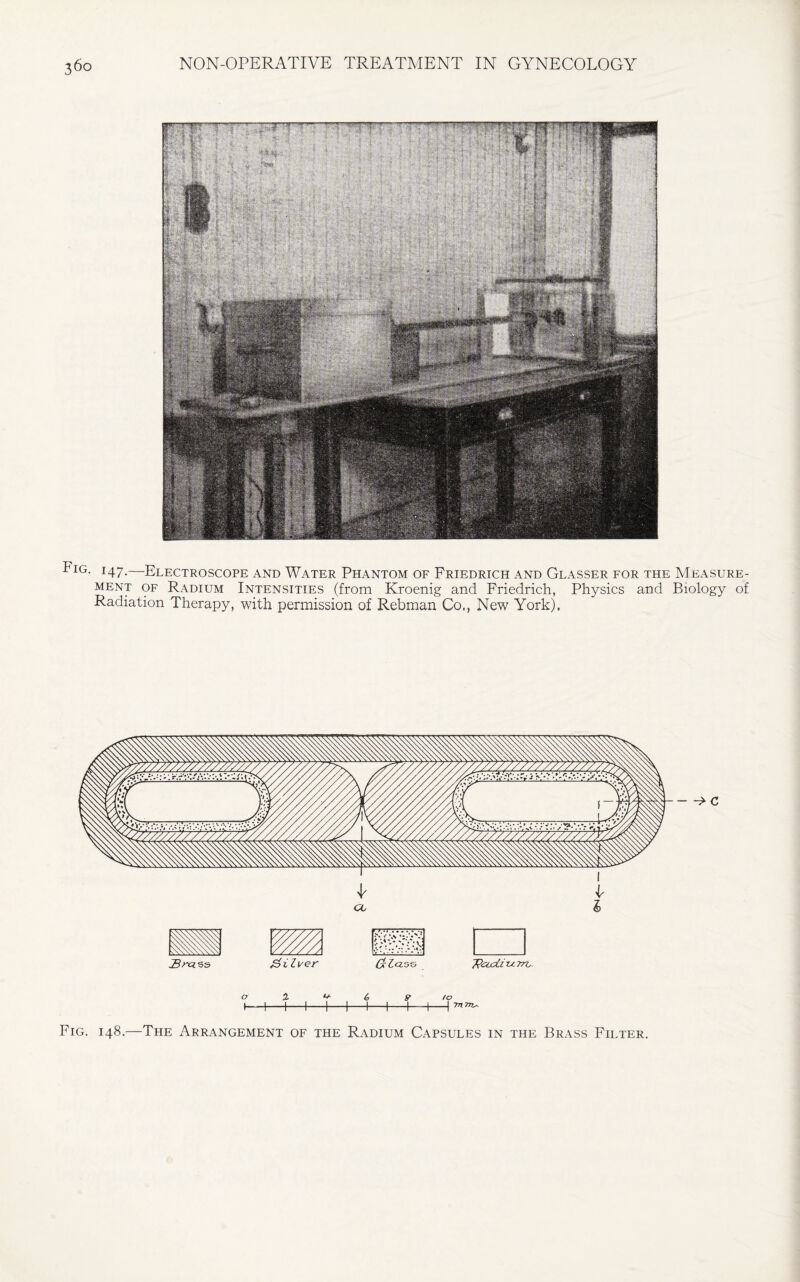 36° Fig. 147.—Electroscope and Water Phantom of Friedrich and Glasser for the Measure¬ ment of Radium Intensities (from Kroenig and Friedrich, Physics and Biology of Radiation Therapy, with permission of Rebman Co., New York). Fig. 148.—The Arrangement of the Radium Capsules in the Brass Filter.