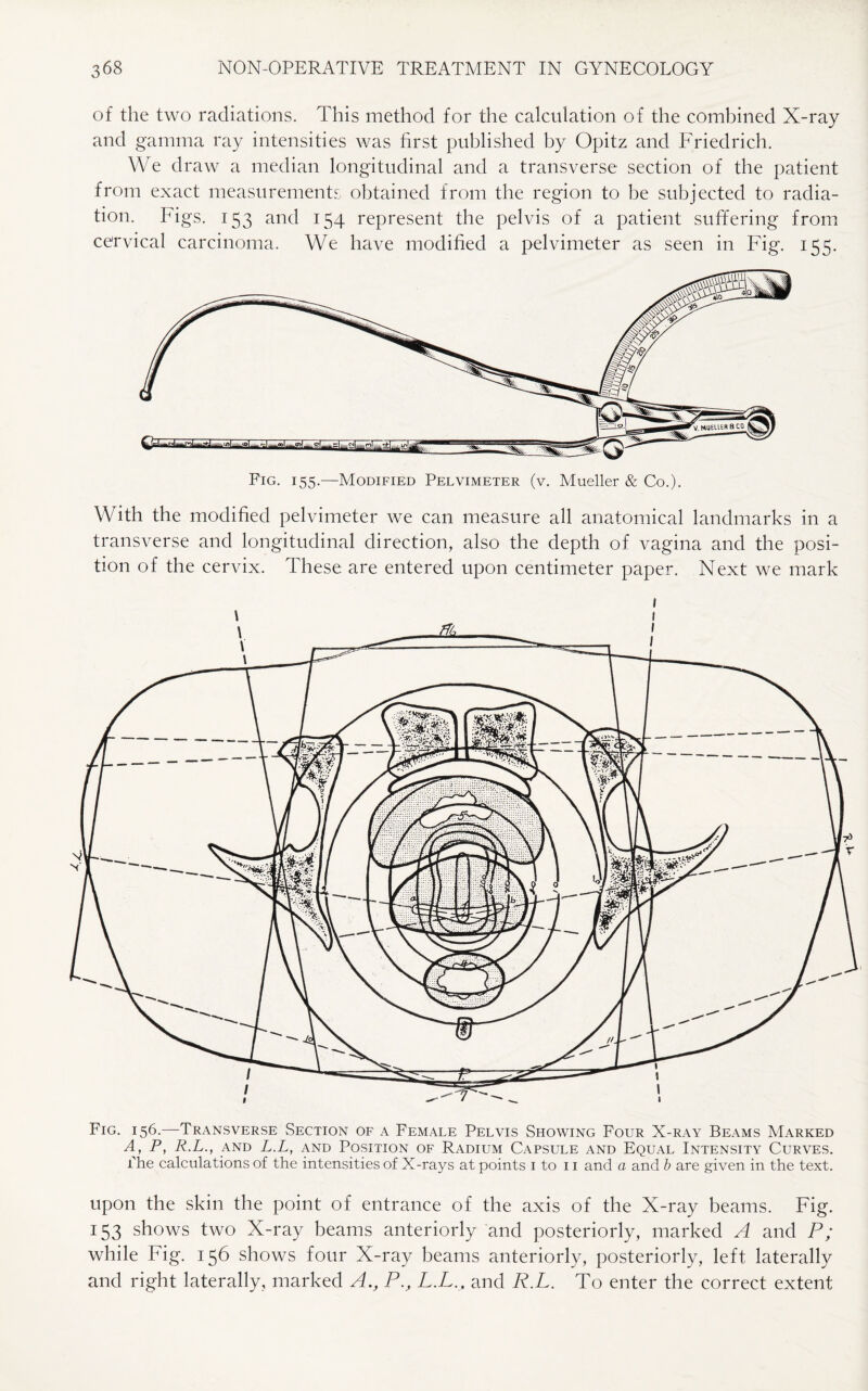 of the two radiations. This method for the calculation of the combined X-ray and gamma ray intensities was first published by Opitz and Friedrich. We draw a median longitudinal and a transverse section of the patient from exact measurements obtained from the region to be subjected to radia¬ tion. lugs. 153 and 154 represent the pelvis of a patient suffering from cervical carcinoma. We have modified a pelvimeter as seen in Fig. 155. With the modified pelvimeter we can measure all anatomical landmarks in a transverse and longitudinal direction, also the depth of vagina and the posi¬ tion of the cervix. These are entered upon centimeter paper. Next we mark Fig. 156.—Transverse Section of a Female Pelvis Showing Four X-ray Beams Marked A, P, R.L., and L.L, and Position of Radium Capsule and Equal Intensity Curves. The calculations of the intensities of X-rays at points 1 to 11 and a and b are given in the text. upon the skin the point of entrance of the axis of the X-ray beams. Fig. 153 shows two X-ray beams anteriorly and posteriorly, marked A and P; while Fig. 156 shows four X-ray beams anteriorly, posteriorly, left laterally and right laterally, marked A., P., LX... and R.L. To enter the correct extent