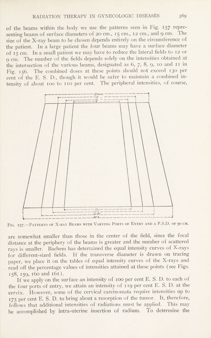 of the beams within the body we use the patterns seen in Fig. 157 repre¬ senting beams of surface diameters of 20 cm., 15 cm., 12 cm., and 9 cm. The size of the X-ray beam to be chosen depends entirely on the circumference of the patient. In a large patient the four beams may have a surface diameter of 13 cm. In a small patient we may have to reduce the lateral fields to 12 or 9 cm. The number of the fields depends solely on the intensities obtained at the intersection of the various beams, designated as 6, 7, 8, 9, 10 and 11 in Fig. 156. The combined doses at these points should not exceed 130 per cent of the E. S. D., though it would be safer to maintain a combined in¬ tensity of about 100 to no per cent. The peripheral intensities, of course, pIG> I-^i—Patterns of X-ray Beams with Varying Ports of Entry and a F.S.D. of 50 cm. are somewhat smaller than those in the center of the field, since the focal distance at the periphery of the beams is greater and the number of scattered rays is smaller. Bachem has determined the equal intensity curves of X-rays for different-sized fields. If the transverse diameter is drawn on tracing paper, we place it on the tables of equal intensity curves of the X-rays and read off the percentage values of intensities attained at these points (see Figs. 158, 159, 160 and 161). If we apply on the surface an intensity of 100 per cent E. S. D. to each of the four ports of entry, we attain an intensity of 119 per cent E. S. D. at the cervix. However, some of the cervical carcinomata require intensities up to 173 per cent E. S. D. to bring about a resorption of the tumor. It, therefore, follows that additional intensities of radiations must be applied. This may be accomplished by intra-uterine insertion of radium. To determine the