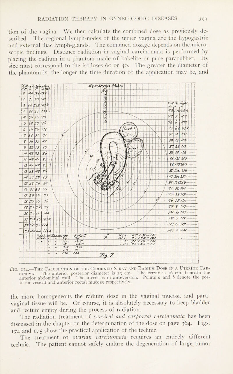 tion of the vagina. We then calculate the combined dose as previously de¬ scribed. The regional lymph-nodes of the upper vagina are the hypogastric and external iliac lvmph-glands. The combined dosage depends on the micro¬ scopic findings. Distance radiation in vaginal carcinomata is performed by placing the radium in a phantom made of bakelite or pure pararubber. Its size must correspond to the isodoses 60 or 40. The greater the diameter of the phantom is, the longer the time duration of the application may be, and Fig. 174.—The Calculation of the Combined X-ray and Radium Dose in a Uterine Car¬ cinoma. The anterior posterior diameter is 23 cm. The cervix is 16 cm. beneath the anterior abdominal wall. The uterus is in anteversion. Points a and b denote the pos¬ terior vesical and anterior rectal mucosae respectively. the more homogeneous the radium dose in the vaginal mucosa and para¬ vaginal tissue will be. Of course, it is absolutely necessary to keep bladder and rectum empty during the process of radiation. The radiation treatment of cervical and corporeal carcinomata has been discussed in the chapter on the determination of the dose on page 364. Figs. 174 and 175 show the practical application of the technic. The treatment of ovarian carcinomata requires an entirely different technic. The patient cannot safely endure the degeneration of large tumor