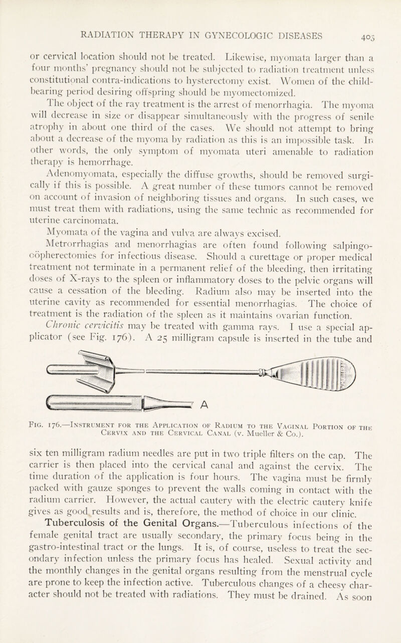 405 or cervical location should not be treated. Likewise, myomata larger than a four months’ pregnancy should not be subjected to radiation treatment unless constitutional contra-indications to hysterectomy exist. Women of the child¬ bearing period desiring offspring should be myomectomized. 1 he object of the ray treatment is the arrest of menorrhagia. The myoma will decrease in size or disappear simultaneously with the progress of senile atrophy in about one third of the cases. We should not attempt to bring about a decrease of the myoma by radiation as this is an impossible task. In other words, the only symptom of myomata uteri amenable to radiation therapy is hemorrhage. A denomyomata, especially the diffuse growths, should be removed surgi¬ cally if this is possible. A great number of these tumors cannot be removed on account of invasion of neighboring tissues and organs. In such cases, we must treat them with radiations, using the same technic as recommended for uterine carcinomata. Myomata of the vagina and vulva are always excised. Metrorrhagias and menorrhagias are often found following salpingo- oopherectomies for infectious disease. Should a curettage or proper medical treatment not terminate in a permanent relief of the bleeding, then irritating doses of X-rays to the spleen or inflammatory doses to the pelvic organs will cause a cessation of the bleeding. Radium also may be inserted into the uterine cavity as recommended for essential menorrhagias. The choice of treatment is the radiation of the spleen as it maintains ovarian function. Chronic cervicitis may be treated with gamma rays. I use a special ap¬ plicator (see Fig. 176). A 25 milligram capsule is inserted in the tube and Fig. 176.—Instrument for the Application of Radium to the Vaginal Portion of the Cervix and the Cervical Canal (v. Mueller & Co.). six ten milligram radium needles are put in two triple filters on the cap. The carrier is then placed into the cervical canal and against the cervix. The time duration of the application is four hours. The vagina must be firmly packed with gauze sponges to prevent the walls coming in contact with the radium carrier. However, the actual cautery with the electric cautery knife gives as good results and is, therefore, the method of choice in our clinic. Tuberculosis of the Genital Organs.—Tuberculous infections of the female genital tract are usually secondary, the primary focus being in the gastro-intestinal tract or the lungs. It is, of course, useless to treat the sec¬ ondary infection unless the primary focus has healed. Sexual activity and the monthly changes in the genital organs resulting from the menstrual cycle are prone to keep the infection active. Tuberculous changes of a cheesy char¬ acter should not be treated with radiations. They must be drained. As soon