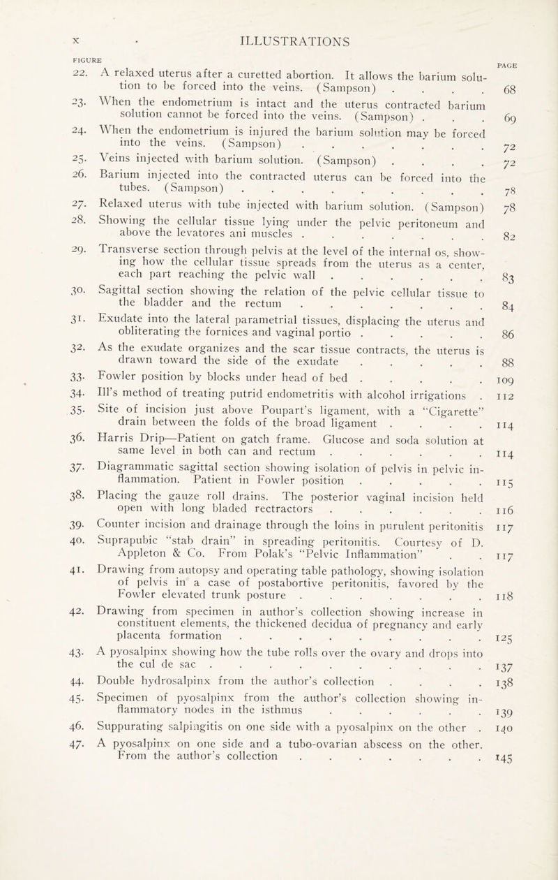 FIGURE 22. A relaxed uterus after a curetted abortion. It allows the barium solu¬ tion to be forced into the veins. (Sampson) . 23. When the endometrium is intact and the uterus contracted barium solution cannot be forced into the veins. (Sampson) . 24. When the endometrium is injured the barium solution may be forced into the veins. (Sampson) ....... 25. Veins injected with barium solution. (Sampson) . 26. Barium injected into the contracted uterus can be forced into the tubes. (Sampson) ........ 27. Relaxed uterus with tube injected with barium solution. (Sampson) 2<S. Showing the cellular tissue lying under the pelvic peritoneum and above the levatores ani muscles ..... 29. Transverse section through pelvis at the level of the internal os, show¬ ing how the cellular tissue spreads from the uterus as a center, each part reaching the pelvic wall. 30. Sagittal section showing the relation of the pelvic cellular tissue to the bladder and the rectum ...... 31. Exudate into the lateral parametrial tissues, displacing the uterus and obliterating the fornices and vaginal portio ..... 32. As the exudate organizes and the scar tissue contracts, the uterus is drawn toward the side of the exudate ..... 33. Fowler position by blocks under head of bed. 34. Ill’s method of treating putrid endometritis with alcohol irrigations . 35. Site of incision just above Poupart’s ligament, with a ‘“Cigarette” drain between the folds of the broad ligament .... 36. Harris Drip—Patient on gatch frame. Glucose and soda solution at same level in both can and rectum ...... 37. Diagrammatic sagittal section showing isolation of pelvis in pelvic in¬ flammation. Patient in Fowler position ..... 38. Placing the gauze roll drains. The posterior vaginal incision held open with long bladed rectractors . . 39. Counter incision and drainage through the loins in purulent peritonitis 40. Suprapubic “stab drain” in spreading peritonitis. Courtesy of D. Appleton & Co. From Polak’s “Pelvic Inflammation” 41. Drawing from autopsy and operating table pathology, showing isolation of pelvis in a case of postabortive peritonitis, favored by the Fowler elevated trunk posture ....... 42. Drawing from specimen in author’s collection showing increase in constituent elements, the thickened decidua of pregnancy and early placenta formation ......... 43- A pyosalpinx showing how the tube rolls over the ovary and drops into the cul de sac .......... 44. Double hydrosalpinx from the author’s collection .... 45. Specimen of pyosalpinx from the author’s collection showing in¬ flammatory nodes in the isthmus ...... 46. Suppurating salpingitis on one side with a pyosalpinx on the other . 47. A pyosalpinx on one side and a tubo-ovarian abscess on the other. From the author’s collection ....... PAGE 68 69 72 72 78 78 82 83 84 86 88 109 112 114 114 115 116 117 117 118 125 137 138 139 140 MS
