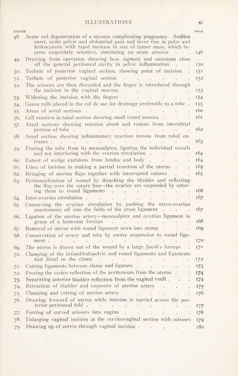 FIGURE PAGE 48. Acute red degeneration of a myoma complicating pregnancy. Sudden onset, acute pelvic and abdominal pain and fever rise in pulse and leukocytosis, with rapid increase in size of tumor mass, which be¬ came exquisitely sensitive, simulating an acute abscess . . 146 49. Drawing from operation showing how sigmoid and omentum close off the general peritoneal cavity in pelvic inflammation . .150 50. Technic of posterior vaginal section, showing point of incision . 15t 51. Technic of posterior vaginal section . . . . . .152 52. The scissors are then discarded and the finger is introduced through the incision in the vaginal mucosa . . . . . 153 53. Widening the incision with the fingers . . . . . .154 54. Gauze rolls placed in the cul de sac for drainage preferable to a tube . 155 55. Areas of serial sections ......... 160 56. Cell reaction in tubal section showing small round mucosa . . .161 57. Areal sections showing reaction about and remote from interstitial portion of tube .......... 162 58. Areal section showing inflammatory reaction remote from tubal en¬ trance ............ 163 59. Freeing the tube from its mesosalpinx, ligating the individual vessels and not interfering with the ovarian circulation .... 164 60. Extent of wedge excisions from fundus and body . . . .164 61. Lines of incision in making a partial resection of the uterus . . 165 62. Bringing of uterine flaps together with interrupted sutures . . 165 63. Peritonealization of wound by detaching the bladder and reflecting the flap over the suture line—the ovaries are suspended by sutur¬ ing them to round ligaments . . . . . . .166 64. Inter-ovarian circulation ......... 167 65. Conserving the ovarian circulation by pushing the utero-ovarian anastomosis off into the folds of the cross ligament . . .167 66. Ligation of the uterine artery—mesosalpinx and ovarian ligament in grasp of a hemostat forceps ....... 168 67. Removal of uterus with round ligament sewn into stump . . . 169 68. Conservation of ovary and tube by suture suspension to round liga¬ ment ............ 170 69. The uterus is drawn out of the wound by a large Jacob's forceps . 171 70. Clamping of the infundibulopelvic and round ligaments and ligaments tied distal to the clamp ........ 172 71. Cutting ligaments between clamp and ligature ..... 173 72. Freeing the vesico reflection of the peritoneum from the uterus . . 174 73. Separating anterior bladder reflection from the vaginal vault . . . 174 74. Retraction of bladder and exposure of uterine artery . . . 175 75. Clamping and cutting of uterine artery ...... 176 76. Drawing forward of uterus while incision is carried across the pos¬ terior peritoneal fold ......... 177 77. Forcing of curved scissors into vagina . . . . . .178 78. Enlarging vaginal incision at the cervicovaginal section with scissors 179 79. Drawing up of cervix through vaginal incision ..... 180